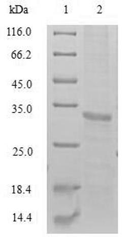 (Tris-Glycine gel) Discontinuous SDS-PAGE (reduced) with 5% enrichment gel and 15% separation gel.