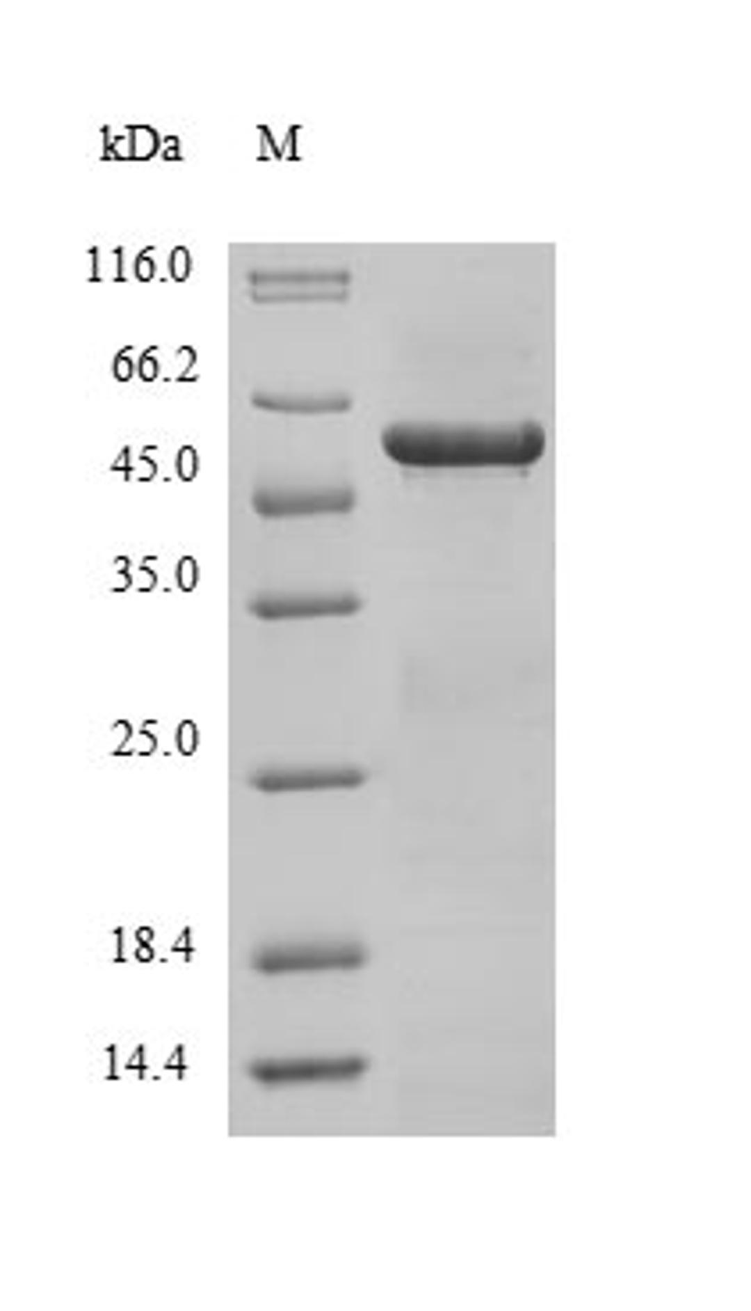 (Tris-Glycine gel) Discontinuous SDS-PAGE (reduced) with 5% enrichment gel and 15% separation gel.