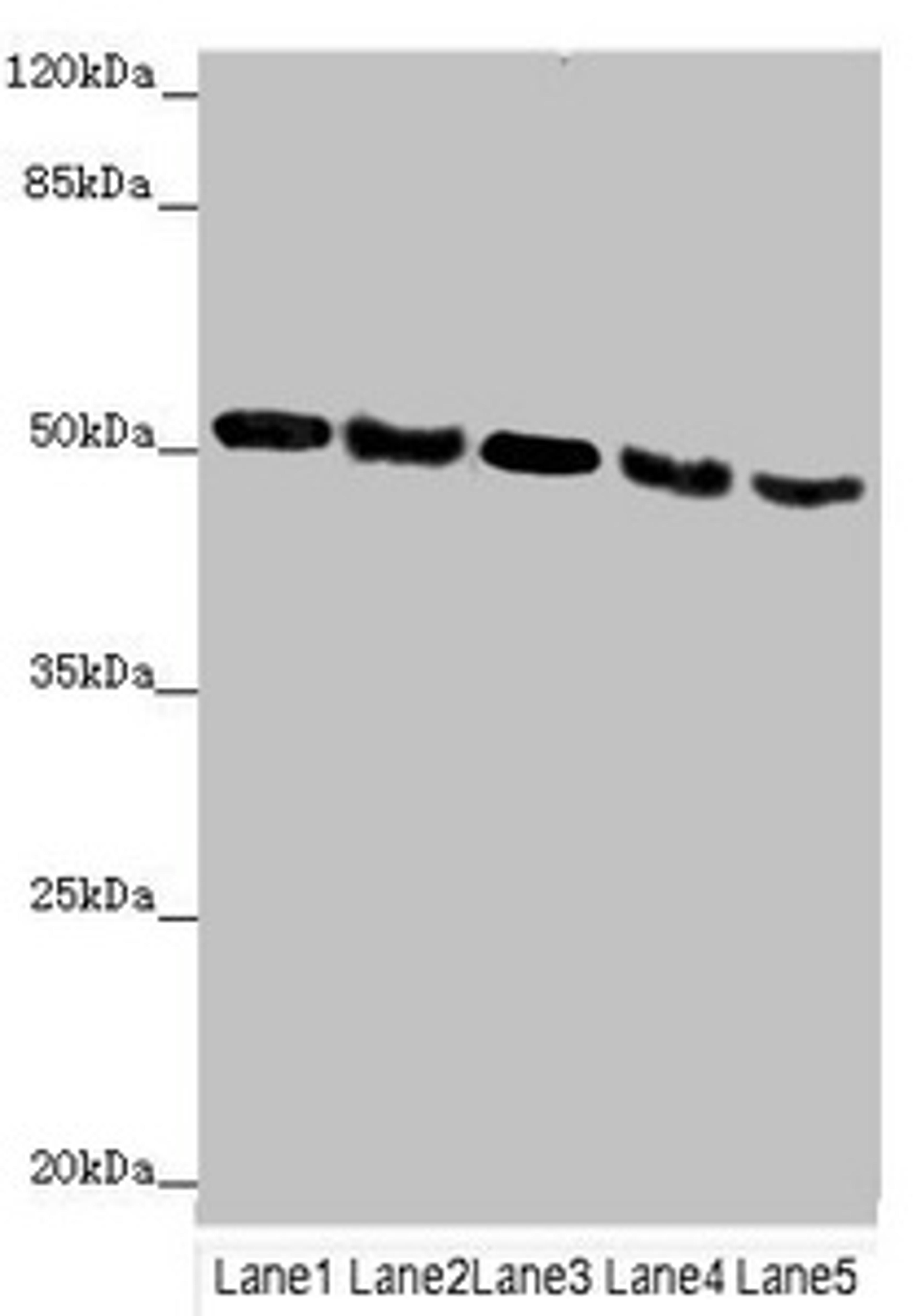 Western blot. All lanes: INPP5K antibody at 4.43µg/ml. Lane 1: Mouse heart tissue. Lane 2: Mouse brain tissue. Lane 3: Mouse skeletal muscle tissue. Lane 4: Hela whole cell lysate. Lane 5: A549 whole cell lysate. Secondary. Goat polyclonal to rabbit IgG at 1/10000 dilution. Predicted band size: 52, 43 kDa. Observed band size: 52 kDa