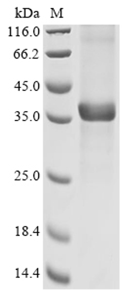 (Tris-Glycine gel) Discontinuous SDS-PAGE (reduced) with 5% enrichment gel and 15% separation gel.