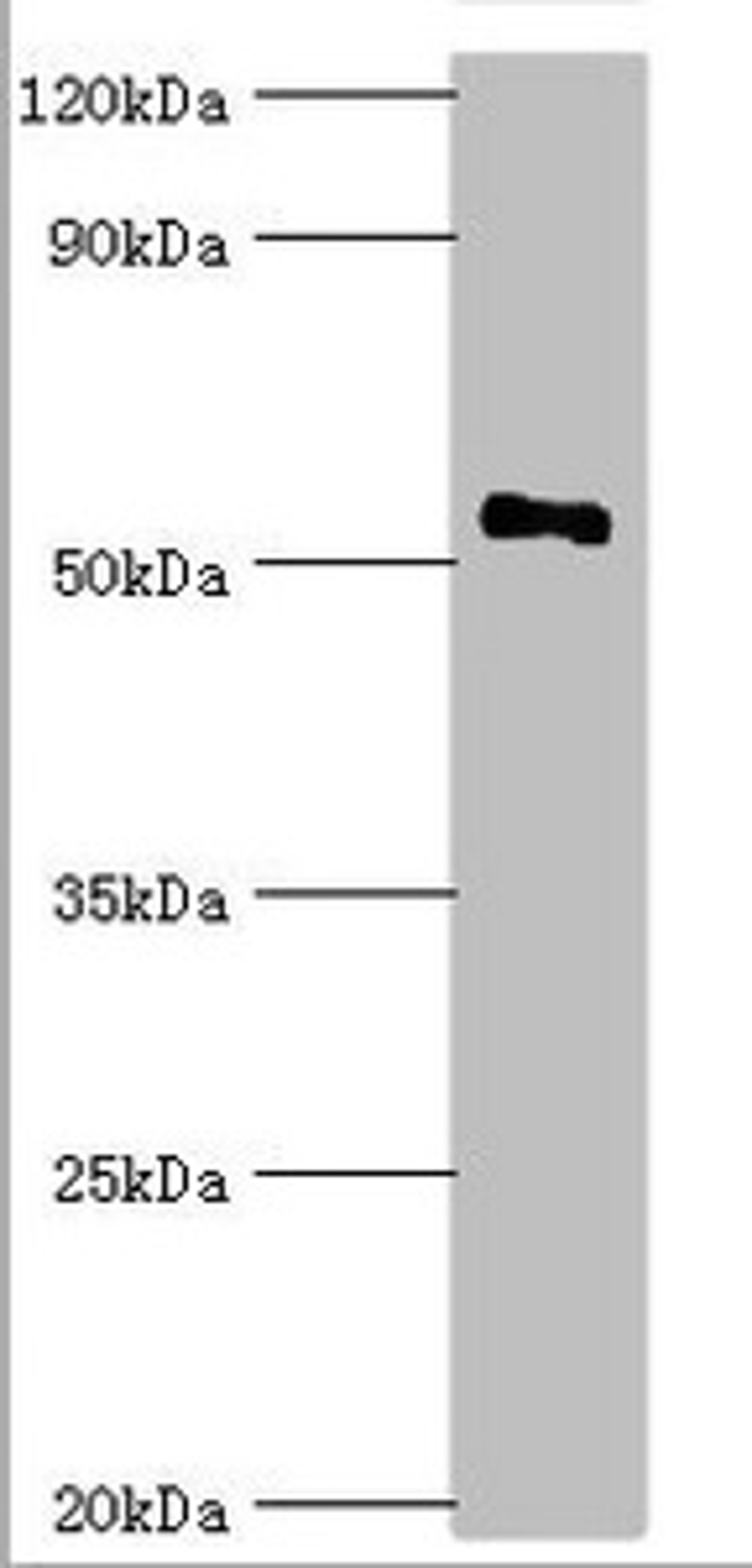 Western blot. All lanes: Mothers against decapentaplegic homolog 9 antibody at 2ug/ml + 293T whole cell lysate. Secondary. Goat polyclonal to rabbit IgG at 1/10000 dilution. Predicted band size: 53, 49 kDa. Observed band size: 53 kDa.