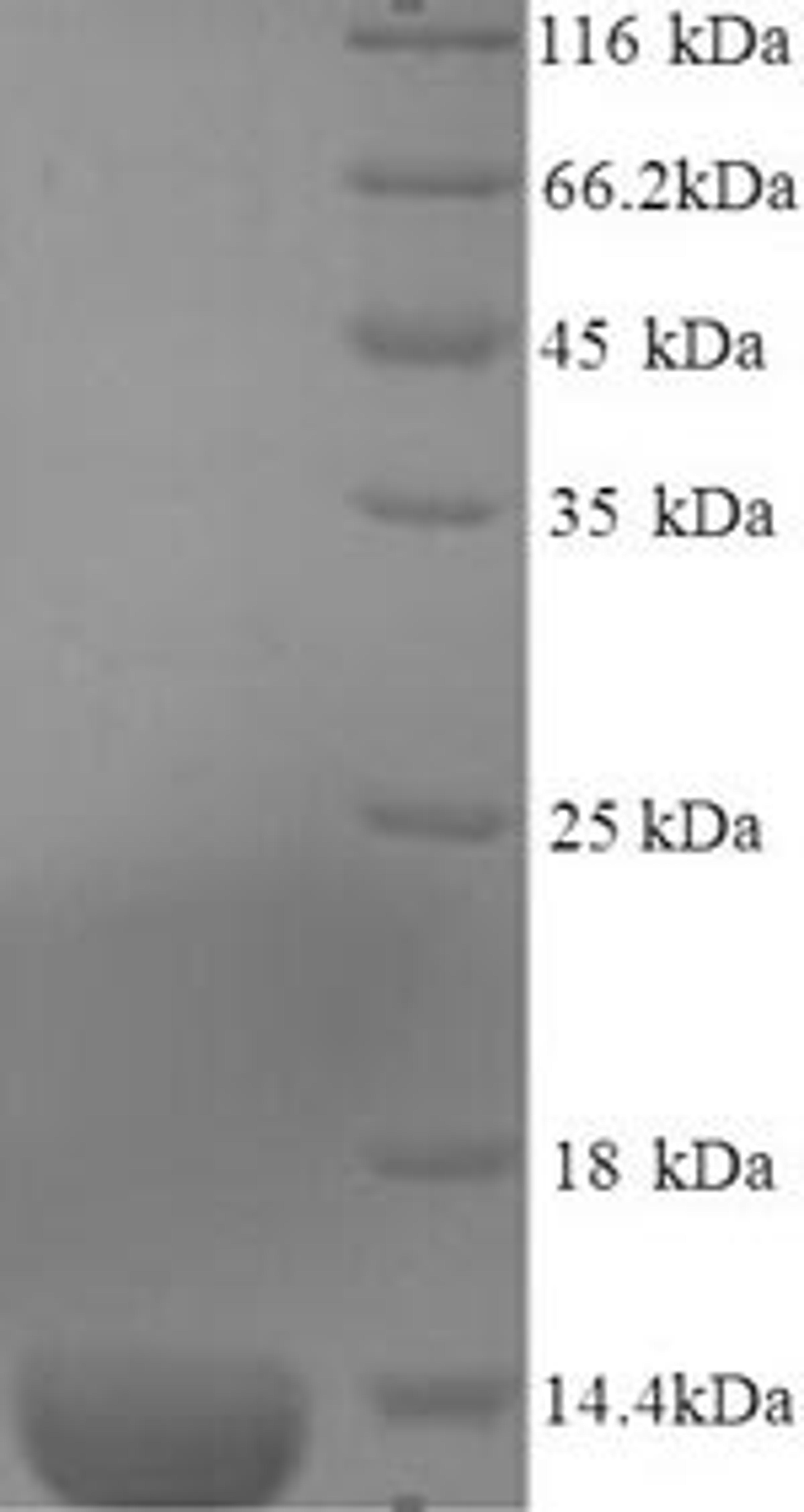(Tris-Glycine gel) Discontinuous SDS-PAGE (reduced) with 5% enrichment gel and 15% separation gel.