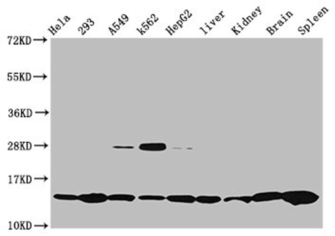 Western Blot. Positive WB detected in: Hela whole cell lysate, 293 whole cell lysate, A549 whole cell lysate, K562 whole cell lysate, HepG2 whole cell lysate, Rat liver tissue, Rat kidney tissue, Mouse brain tissue, Mouse spleen tissue. All lanes: HIST1H2BC antibody at 0.47µg/ml. Secondary. Goat polyclonal to rabbit IgG at 1/50000 dilution. Predicted band size: 14 kDa. Observed band size: 14 kDa
