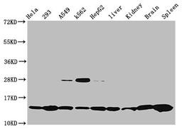 Western Blot. Positive WB detected in: Hela whole cell lysate, 293 whole cell lysate, A549 whole cell lysate, K562 whole cell lysate, HepG2 whole cell lysate, Rat liver tissue, Rat kidney tissue, Mouse brain tissue, Mouse spleen tissue. All lanes: HIST1H2BC antibody at 0.47µg/ml. Secondary. Goat polyclonal to rabbit IgG at 1/50000 dilution. Predicted band size: 14 kDa. Observed band size: 14 kDa