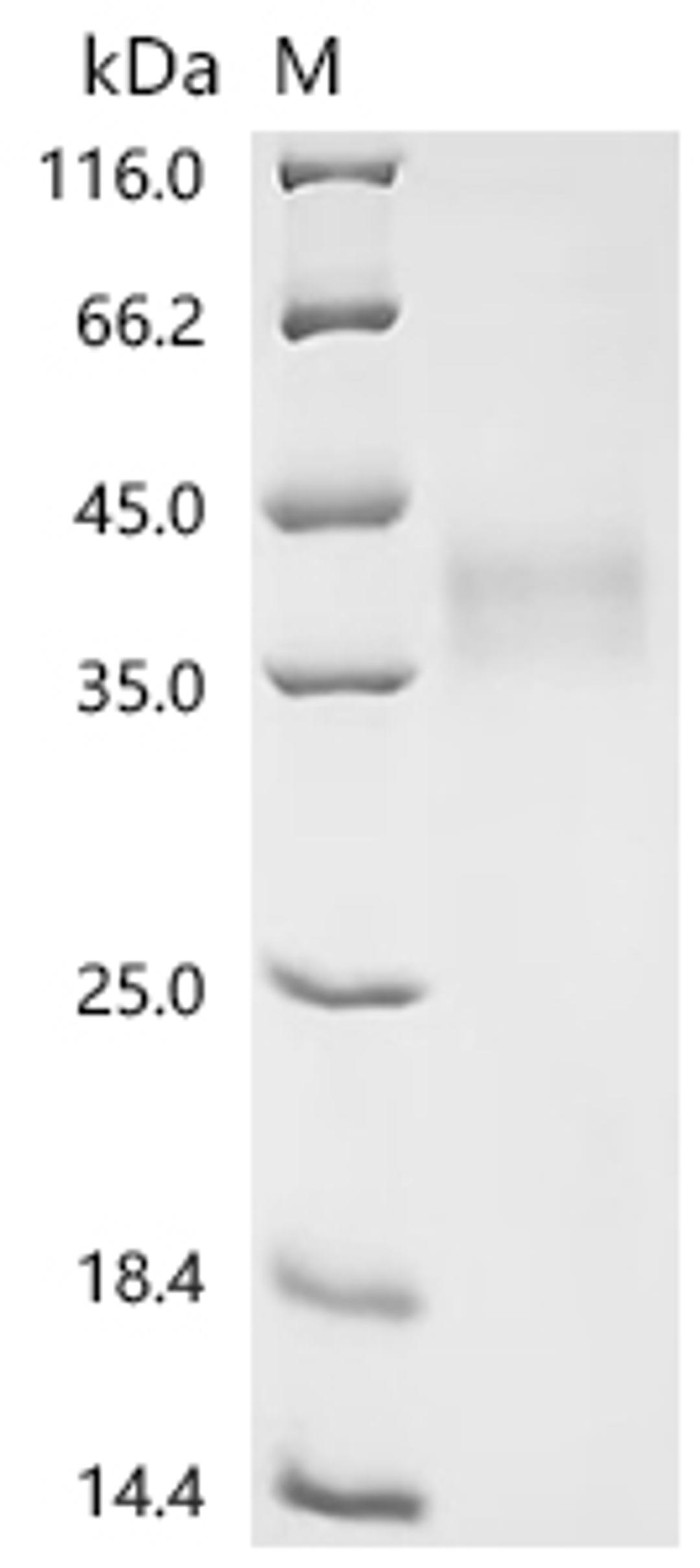 (Tris-Glycine gel) Discontinuous SDS-PAGE (reduced) with 5% enrichment gel and 15% separation gel.