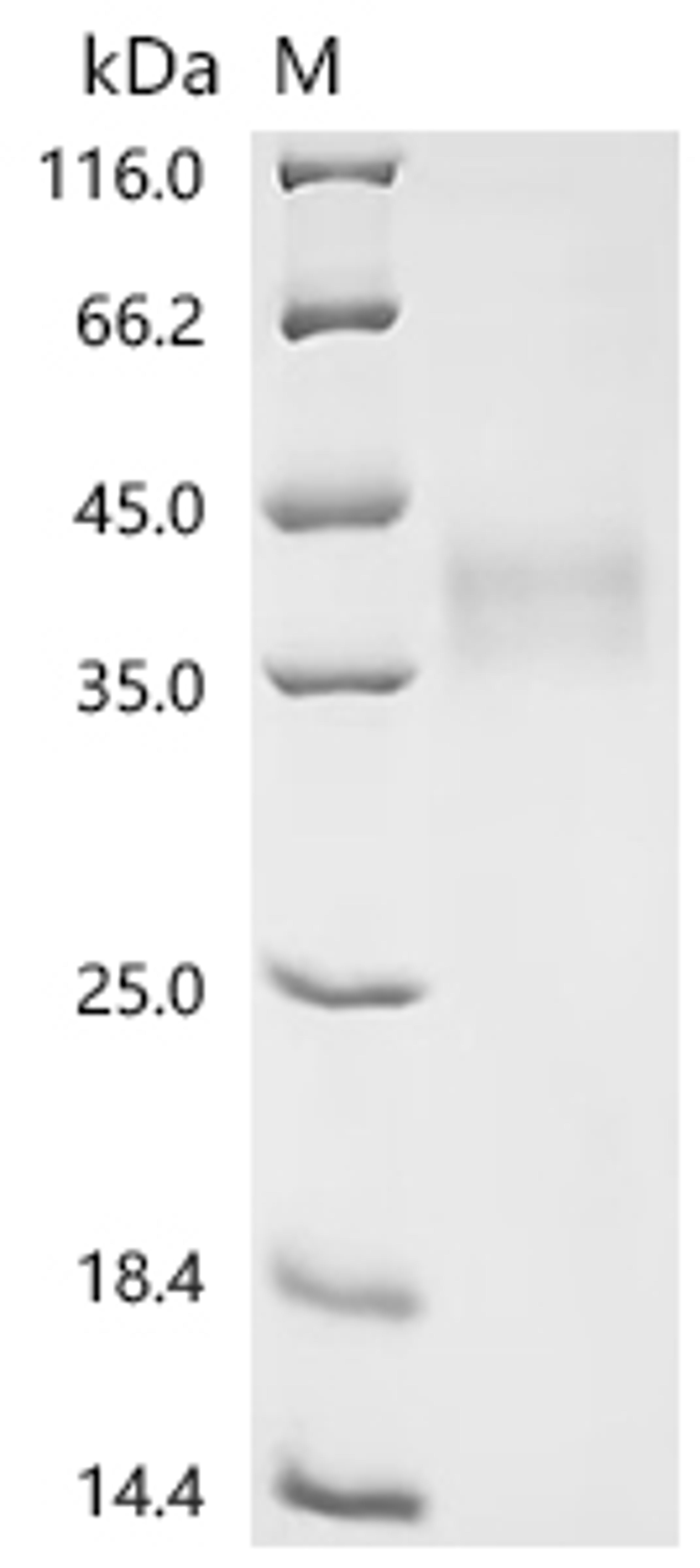 (Tris-Glycine gel) Discontinuous SDS-PAGE (reduced) with 5% enrichment gel and 15% separation gel.