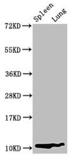 Western Blot. Positive WB detected in: Rat spleen tissue, Rat lung tissue. All lanes: S100a8 antibody at 3.2µg/ml. Secondary. Goat polyclonal to rabbit IgG at 1/50000 dilution. Predicted band size: 11 kDa. Observed band size: 11 kDa