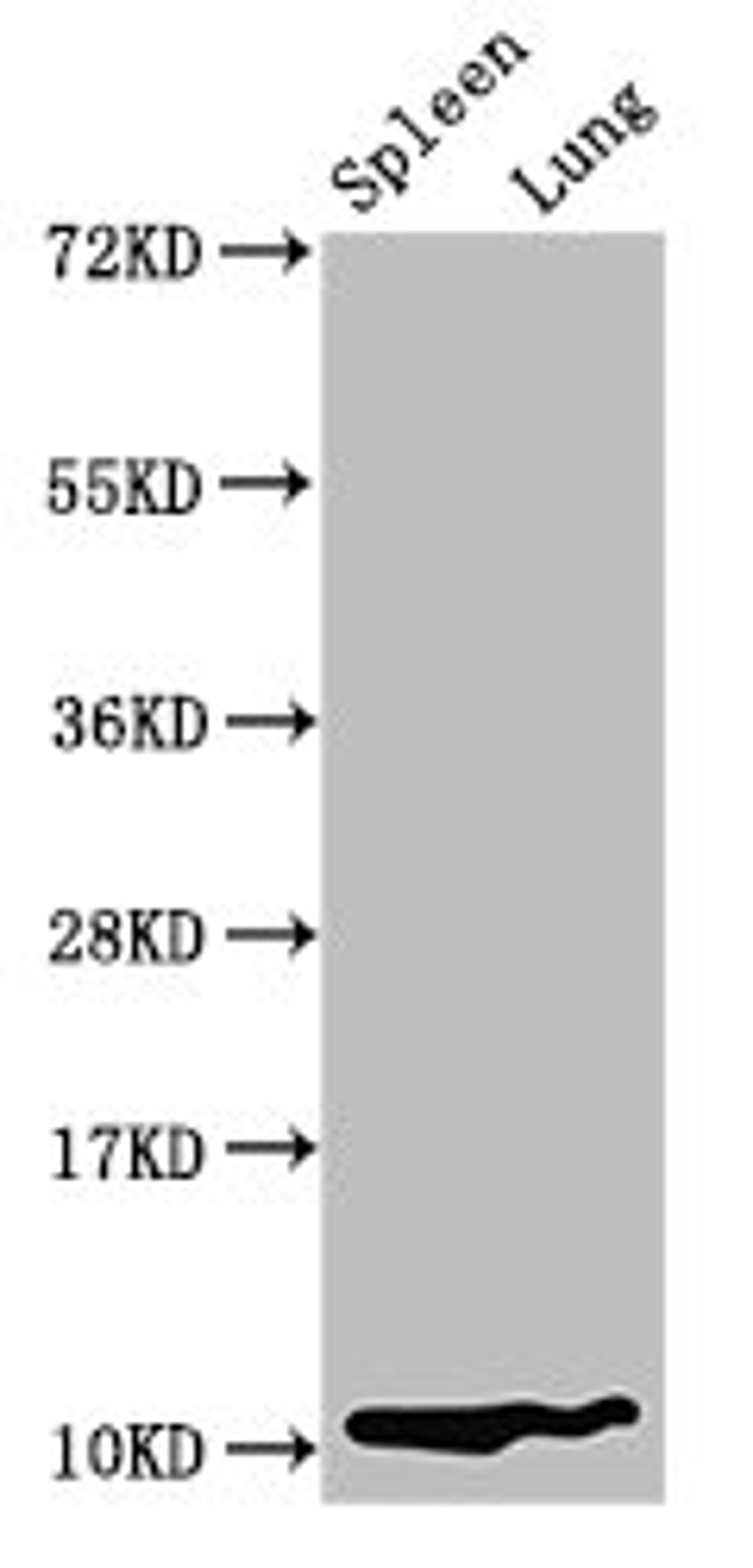 Western Blot. Positive WB detected in: Rat spleen tissue, Rat lung tissue. All lanes: S100a8 antibody at 3.2µg/ml. Secondary. Goat polyclonal to rabbit IgG at 1/50000 dilution. Predicted band size: 11 kDa. Observed band size: 11 kDa