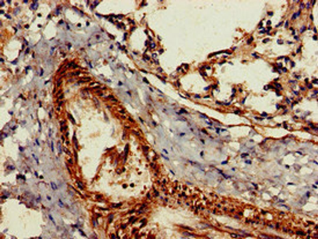 Immunohistochemistry of paraffin-embedded human lung tissue using CSB-PA010084LA01HU at dilution of 1:100