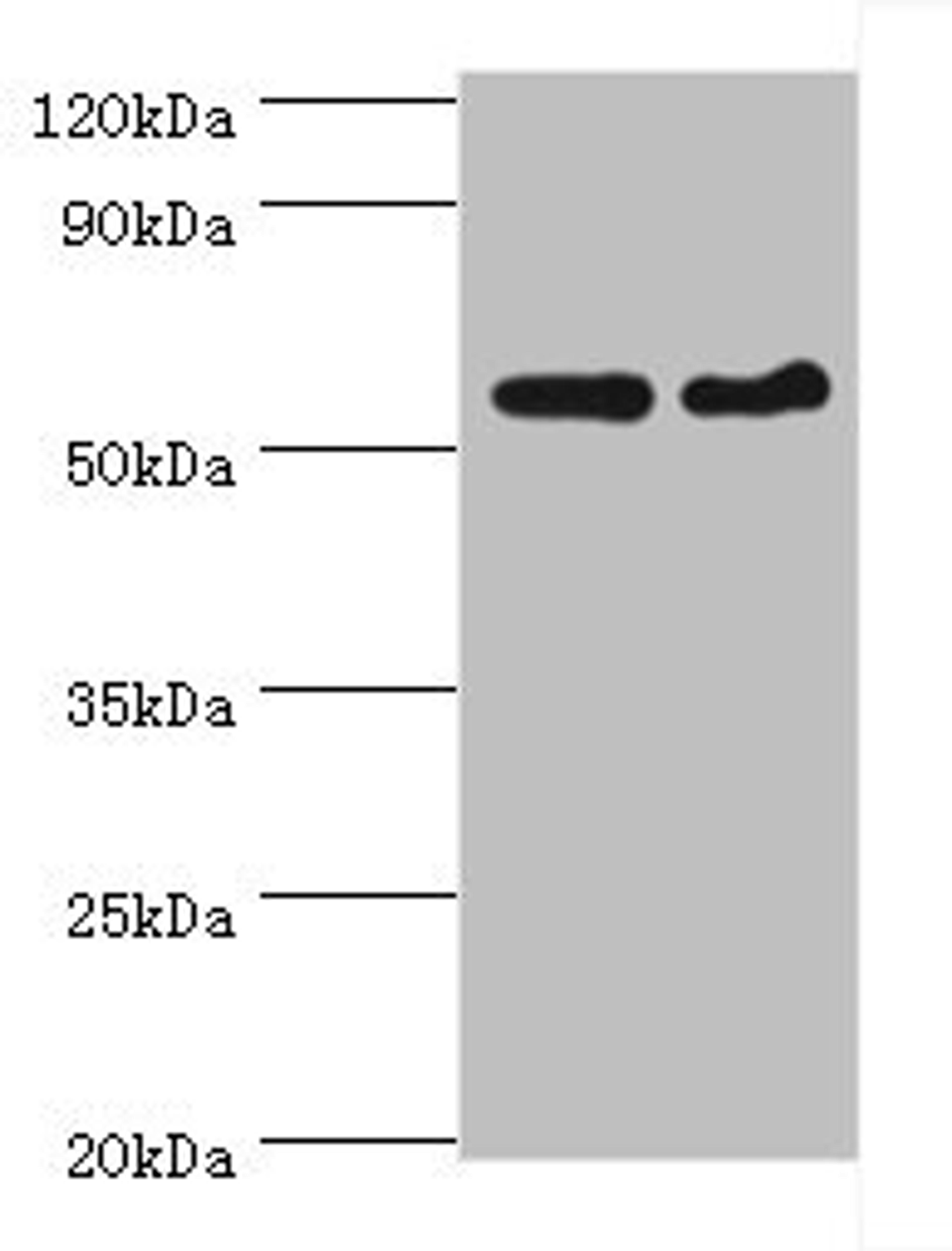 Western blot. All lanes: CDK16 antibody at 5ug/ml. Lane 1: Mouse brain tissue. Lane 2: Mouse small intestine tissue. Secondary. Goat polyclonal to rabbit IgG at 1/10000 dilution. Predicted band size: 56, 64, 57 kDa. Observed band size: 56 kDa.