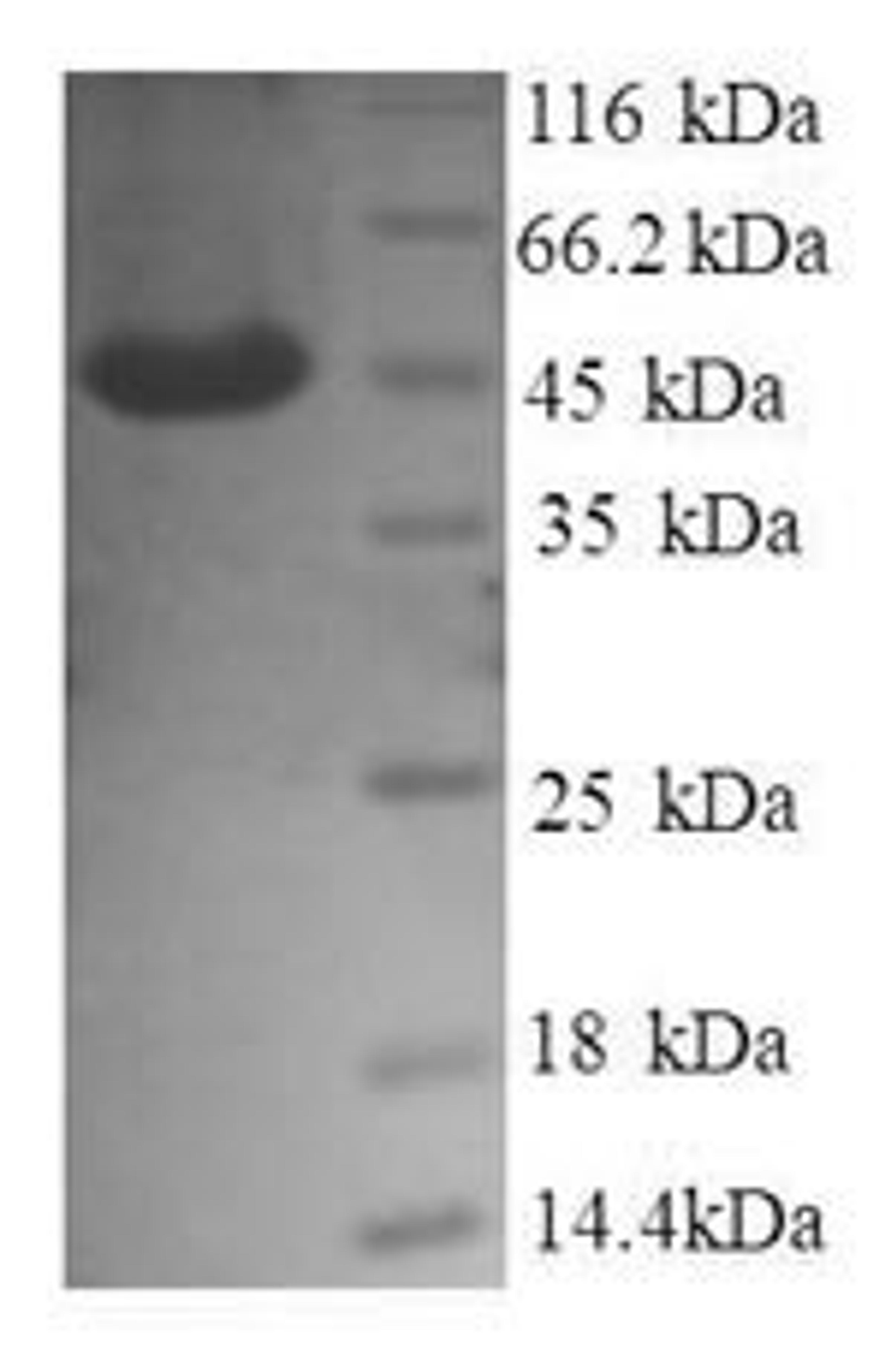 (Tris-Glycine gel) Discontinuous SDS-PAGE (reduced) with 5% enrichment gel and 15% separation gel.