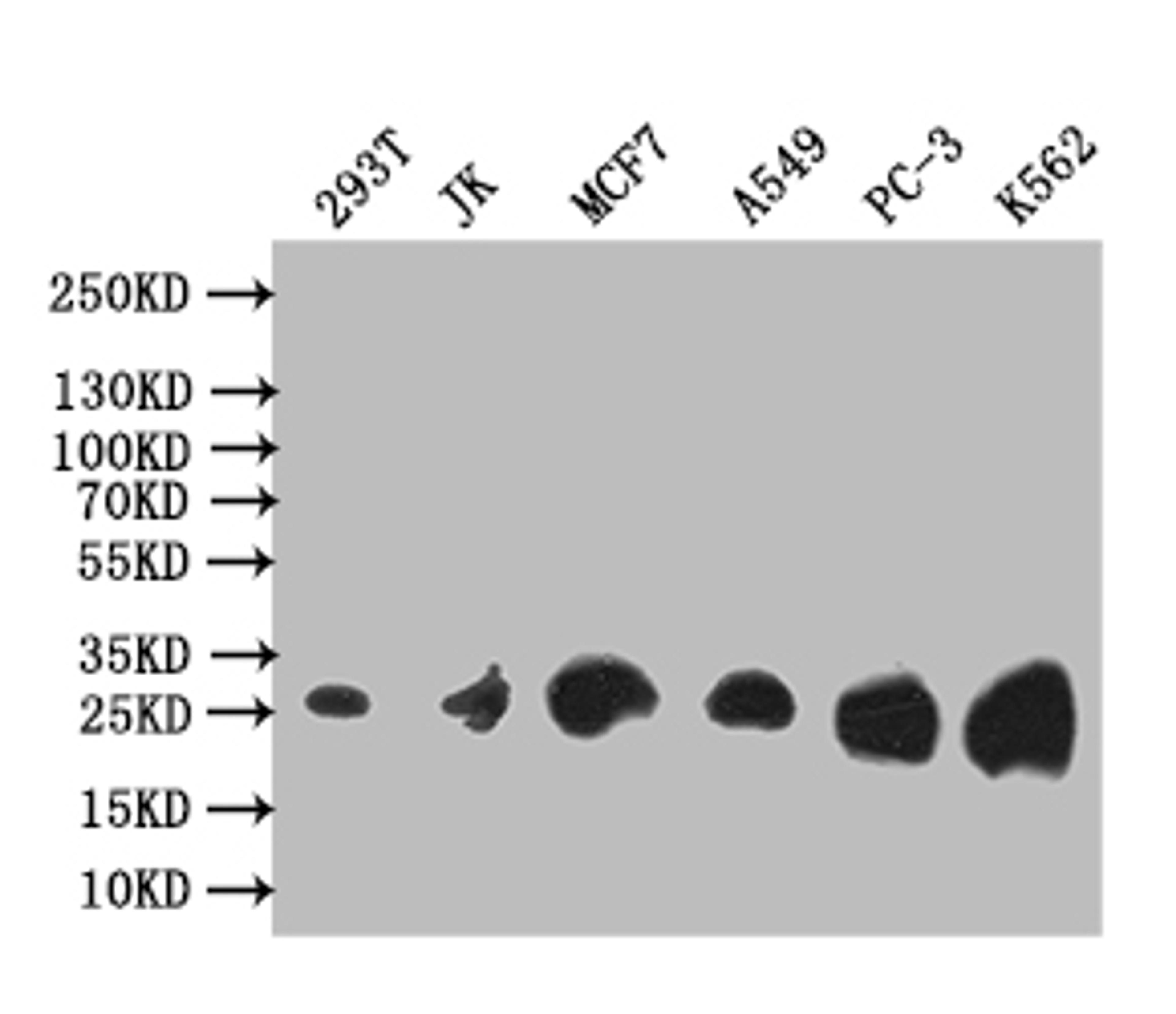 Western Blot. Positive WB detected in: 293T whole cell lysate, JK whole cell lysate, MCF7 whole cell lysate, A549 whole cell lysate, PC-3 whole cell lysate, K562 whole cell lysate. All lanes: Thymidine Kinase 1 antibody at 1:1000. Secondary. Goat polyclonal to rabbit IgG at 1/50000 dilution. Predicted band size: 26 kDa. Observed band size: 26 kDa. 