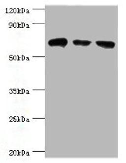 Western blot. All lanes: HSPA2 antibody at 6ug/ml. Lane 1: A431 whole cell lysate. Lane 2: Hela whole cell lysate. Lane 3: Rat brain tissue. Secondary. Goat polyclonal to rabbit IgG at 1/10000 dilution. Predicted band size: 70 kDa. Observed band size: 70 kDa. 