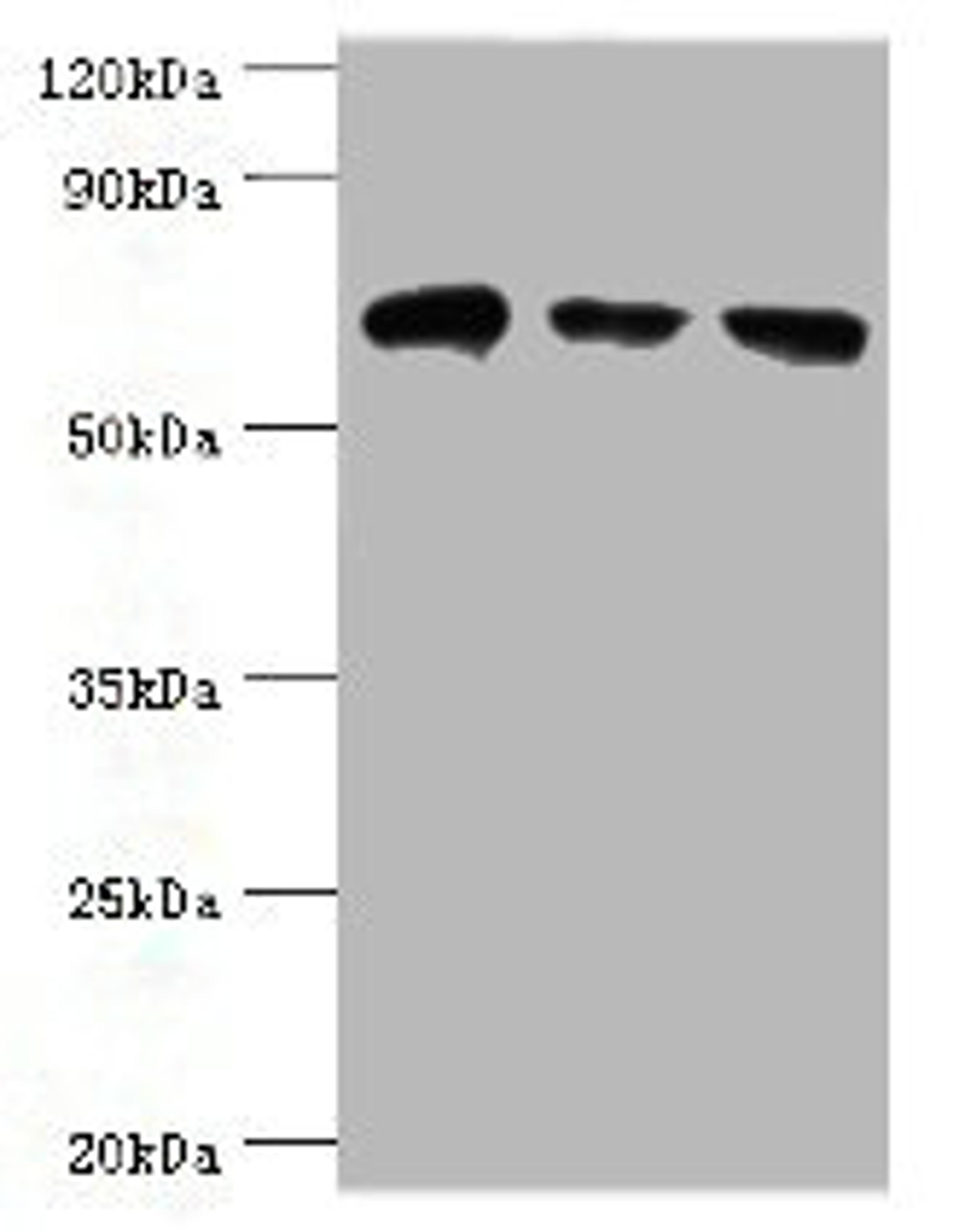 Western blot. All lanes: HSPA2 antibody at 6ug/ml. Lane 1: A431 whole cell lysate. Lane 2: Hela whole cell lysate. Lane 3: Rat brain tissue. Secondary. Goat polyclonal to rabbit IgG at 1/10000 dilution. Predicted band size: 70 kDa. Observed band size: 70 kDa. 