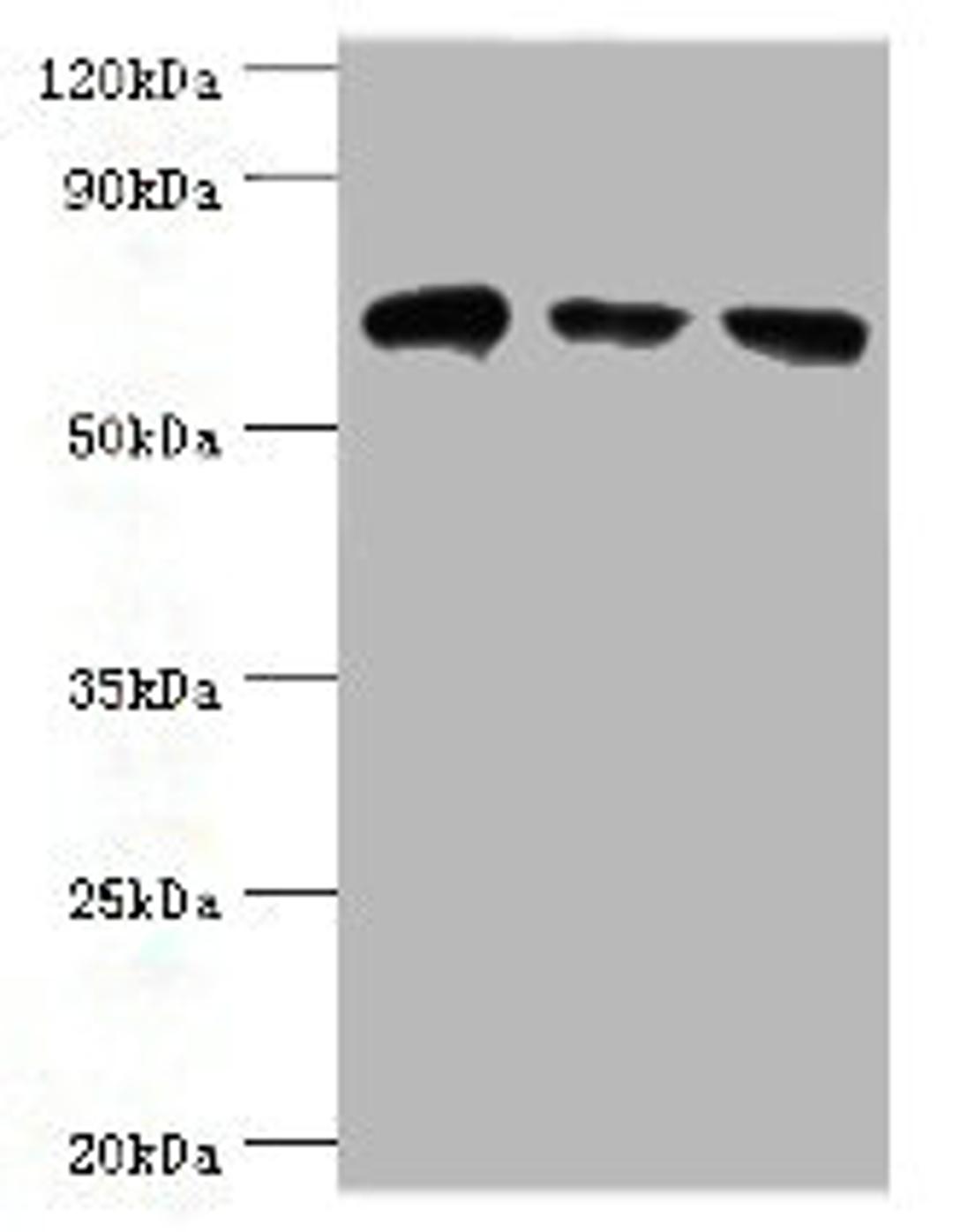Western blot. All lanes: HSPA2 antibody at 6ug/ml. Lane 1: A431 whole cell lysate. Lane 2: Hela whole cell lysate. Lane 3: Rat brain tissue. Secondary. Goat polyclonal to rabbit IgG at 1/10000 dilution. Predicted band size: 70 kDa. Observed band size: 70 kDa.