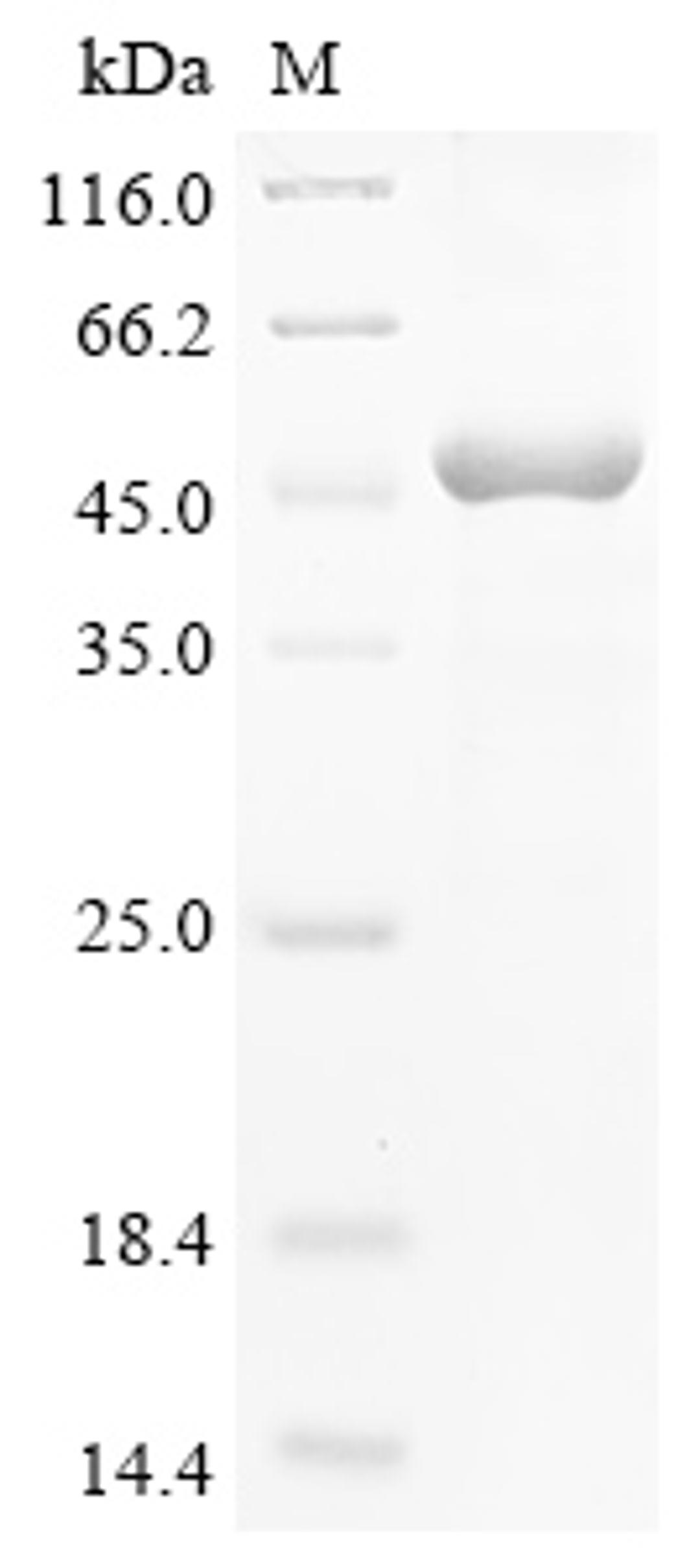 (Tris-Glycine gel) Discontinuous SDS-PAGE (reduced) with 5% enrichment gel and 15% separation gel.