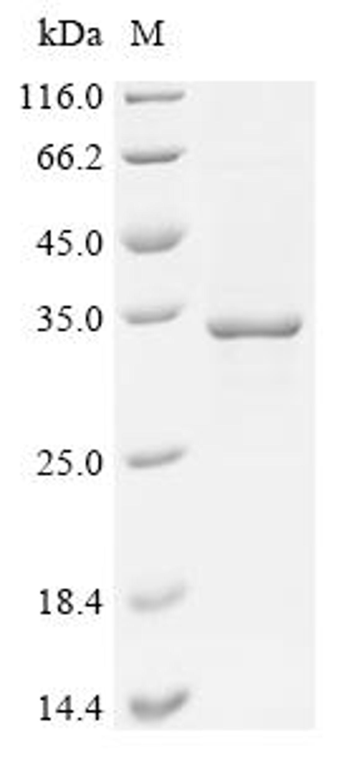 (Tris-Glycine gel) Discontinuous SDS-PAGE (reduced) with 5% enrichment gel and 15% separation gel.