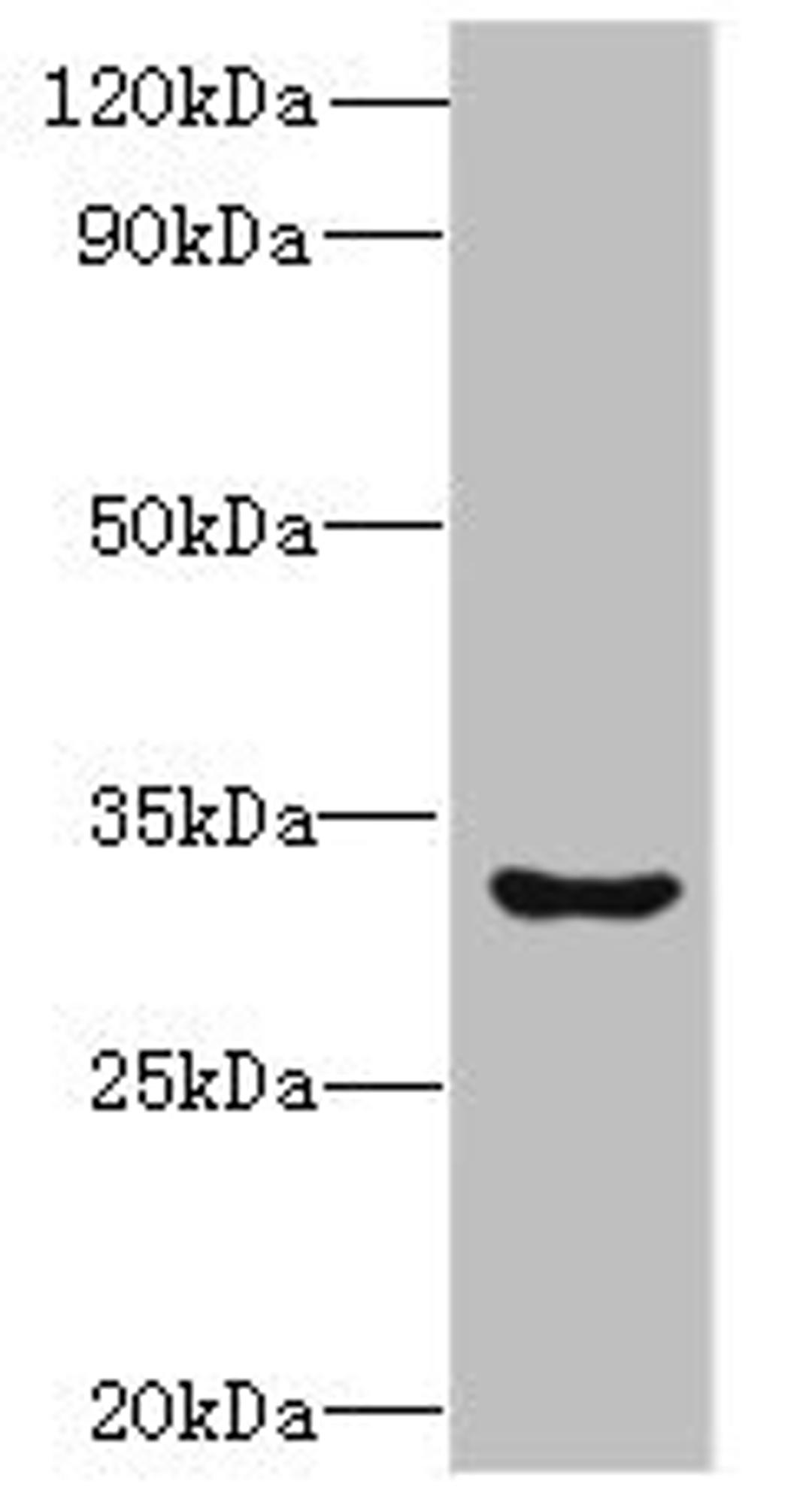 Western blot. All lanes: CLEC1A antibody at 6µg/ml + Mouse thymus tissue. Secondary. Goat polyclonal to rabbit IgG at 1/10000 dilution. Predicted band size: 32 kDa. Observed band size: 32 kDa
