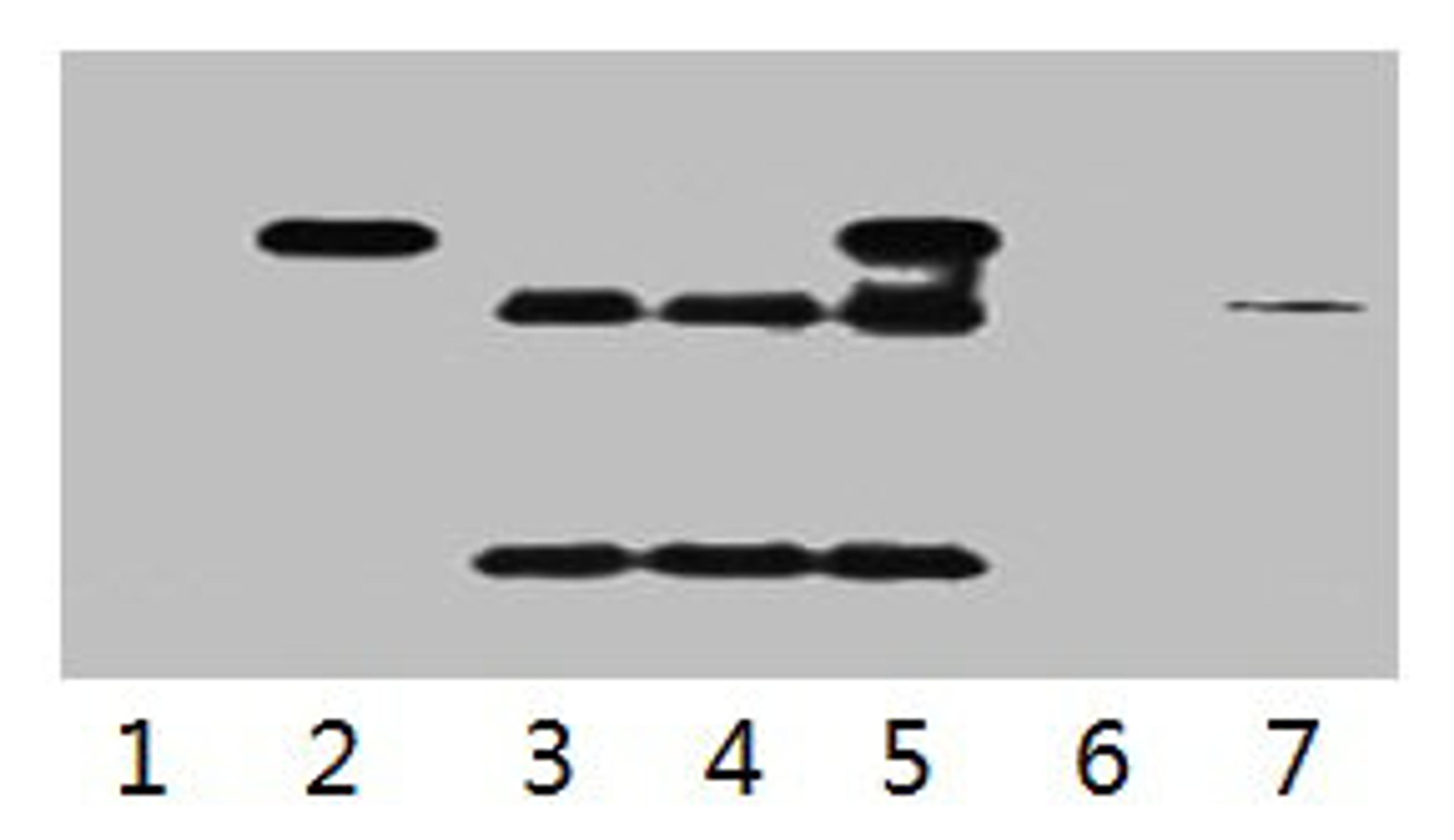 IP antibody use: 5µg HA Mouse IgG1 per ml Lysate, WB 1:5000. Lane 1: untransfected 293 cell lysate. Lane 2: transfected 293 cell lysate with HA-tag fusion protein. Lane 3: IP (untransfted 293 + anti-HA mAb + Protein G agarose). Lane 4: IP (transfected 293 + normal Mouse IgG + Protein G agarose). Lane 5: IP (transfected 293 + anti-HA mAb + Protein G agarose). Lane 6: IP (transfected 293 + Protein G). Lane 7: Recombinant protein (E.coli). 
