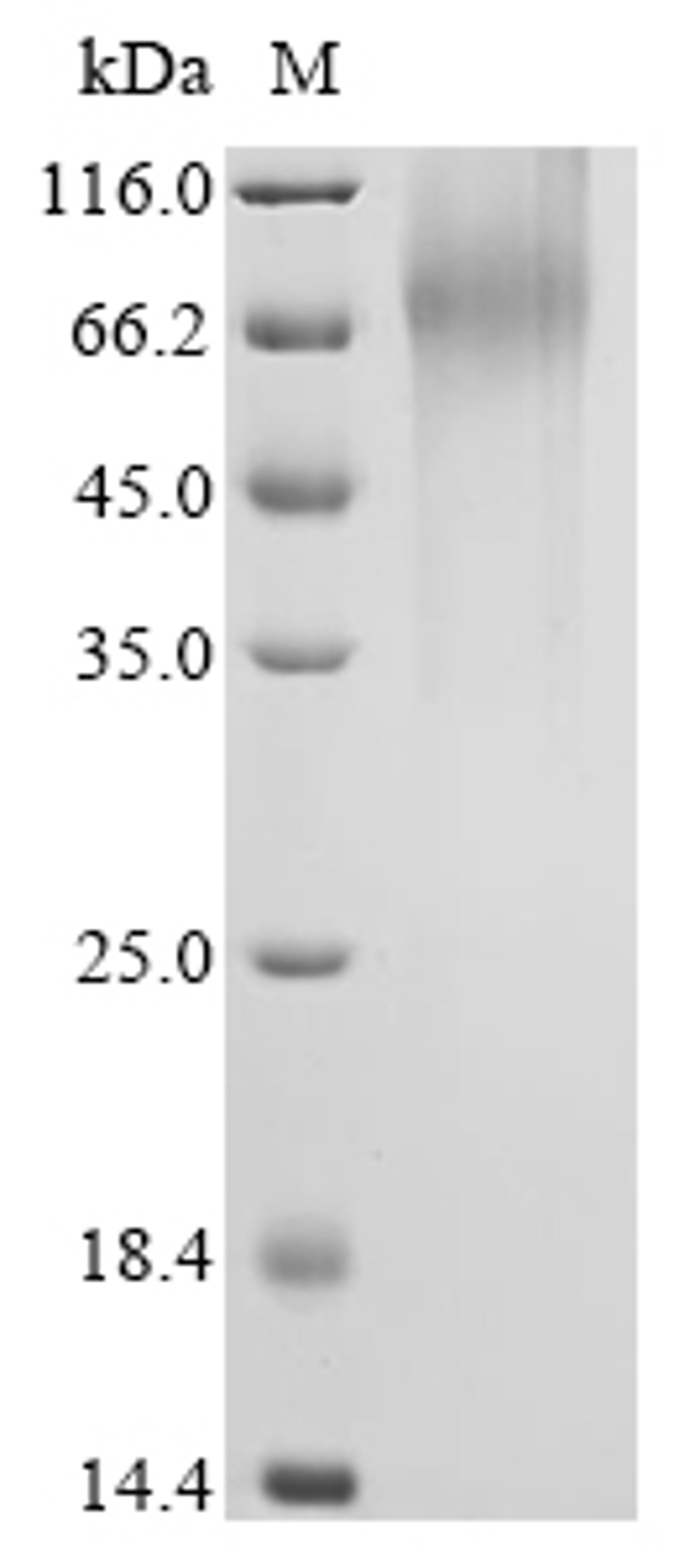 (Tris-Glycine gel) Discontinuous SDS-PAGE (reduced) with 5% enrichment gel and 15% separation gel.
