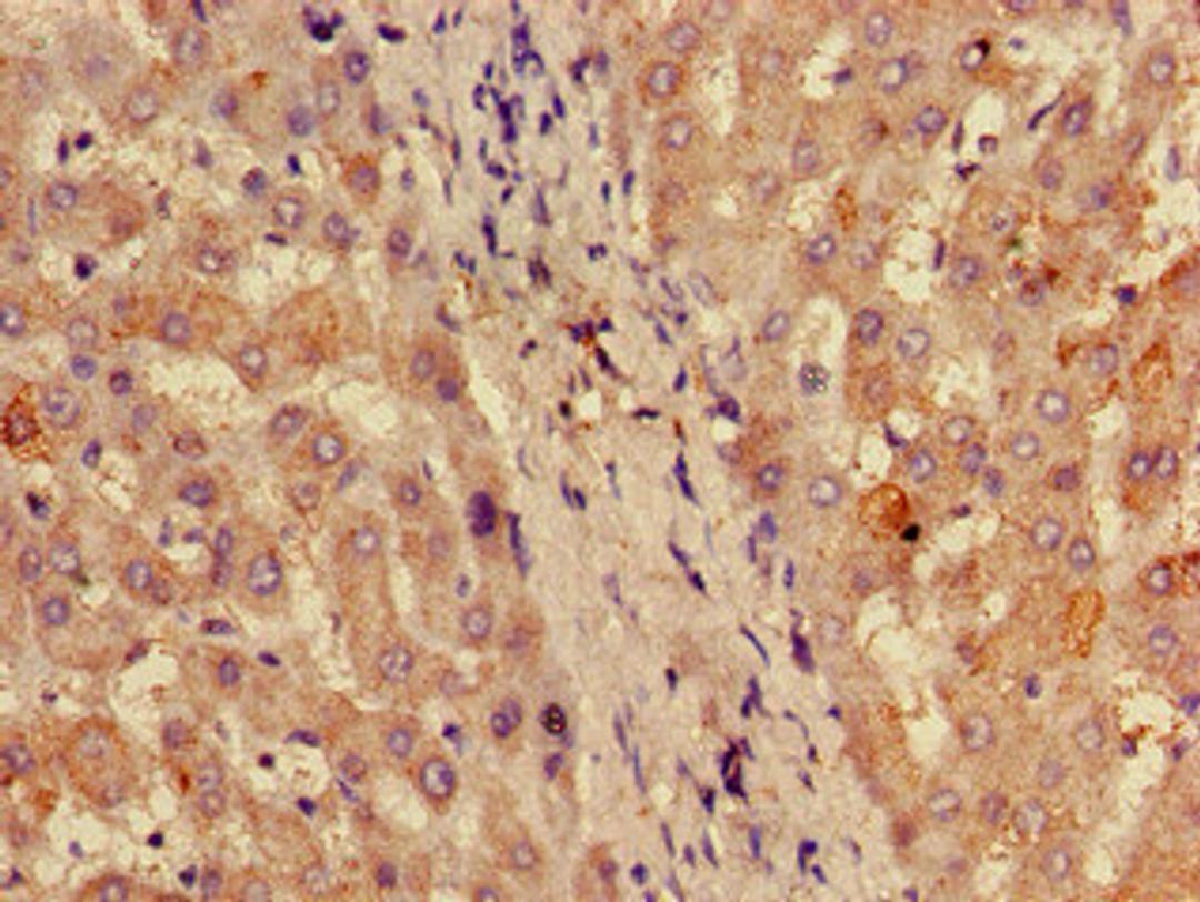 Immunohistochemistry of paraffin-embedded human liver tissue using CSB-PA020217ED01HU at dilution of 1:100