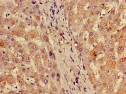 Immunohistochemistry of paraffin-embedded human liver tissue using CSB-PA020217ED01HU at dilution of 1:100