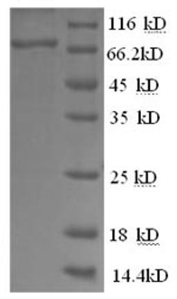 (Tris-Glycine gel) Discontinuous SDS-PAGE (reduced) with 5% enrichment gel and 15% separation gel.