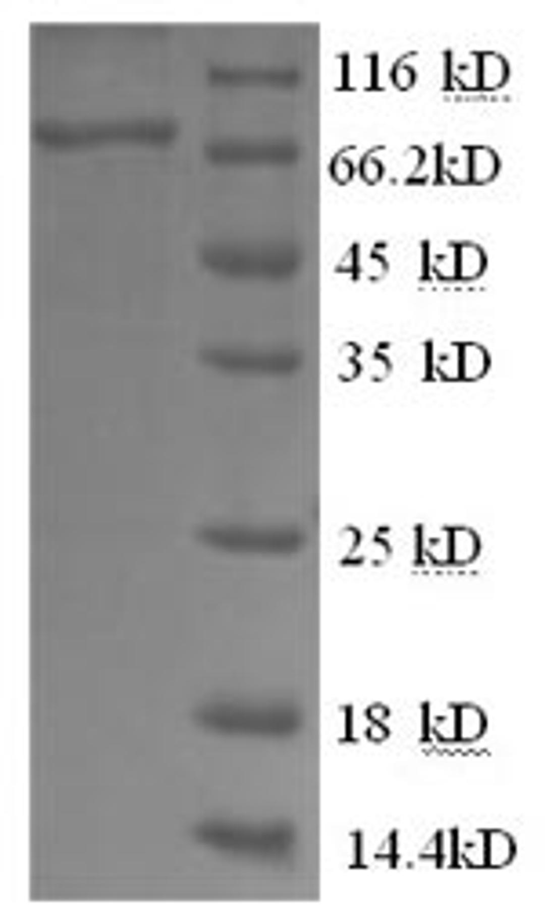 (Tris-Glycine gel) Discontinuous SDS-PAGE (reduced) with 5% enrichment gel and 15% separation gel.