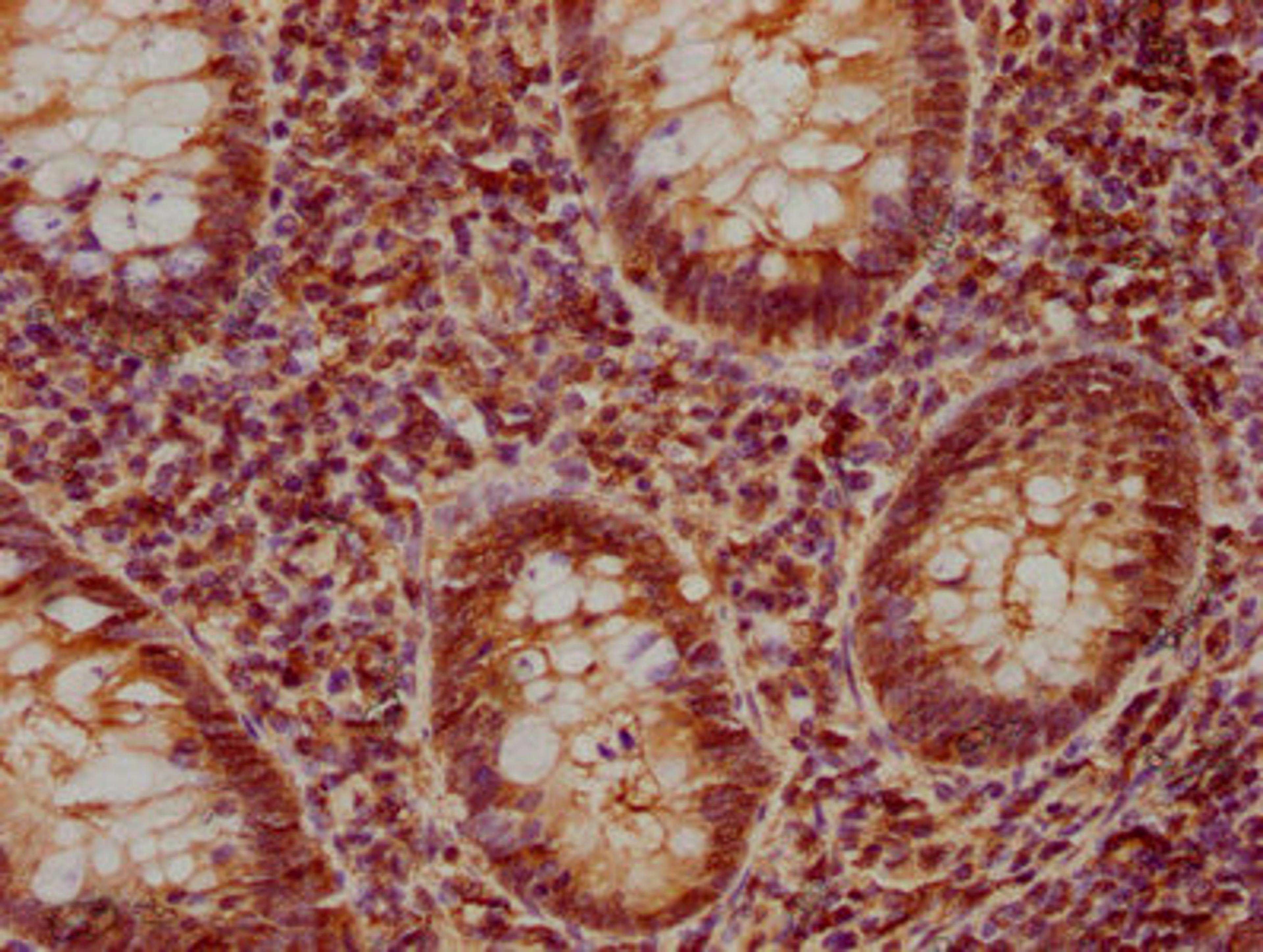 IHC image of CSB-PA621644NA01HU diluted at 1:840 and staining in paraffin-embedded human appendix tissue performed on a Leica BondTM system. After dewaxing and hydration, antigen retrieval was mediated by high pressure in a citrate buffer (pH 6.0). Section was blocked with 10% normal goat serum 30min at RT. Then primary antibody (1% BSA) was incubated at 4°C overnight. The primary is detected by a biotinylated secondary antibody and visualized using an HRP conjugated SP system.