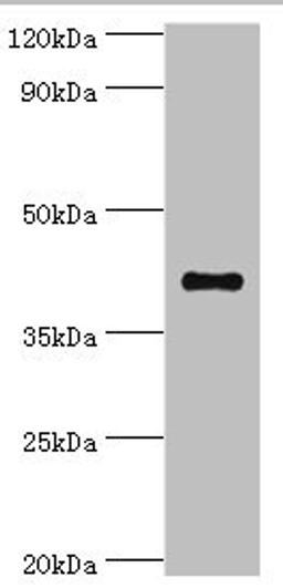 Western blot. All lanes: Sulfotransferase family cytosolic 2B member 1 antibody at 4ug/ml + MCF-7 whole cell lysate. Secondary. Goat polyclonal to rabbit IgG at 1/10000 dilution. Predicted band size: 42, 40 kDa. Observed band size: 42 kDa.