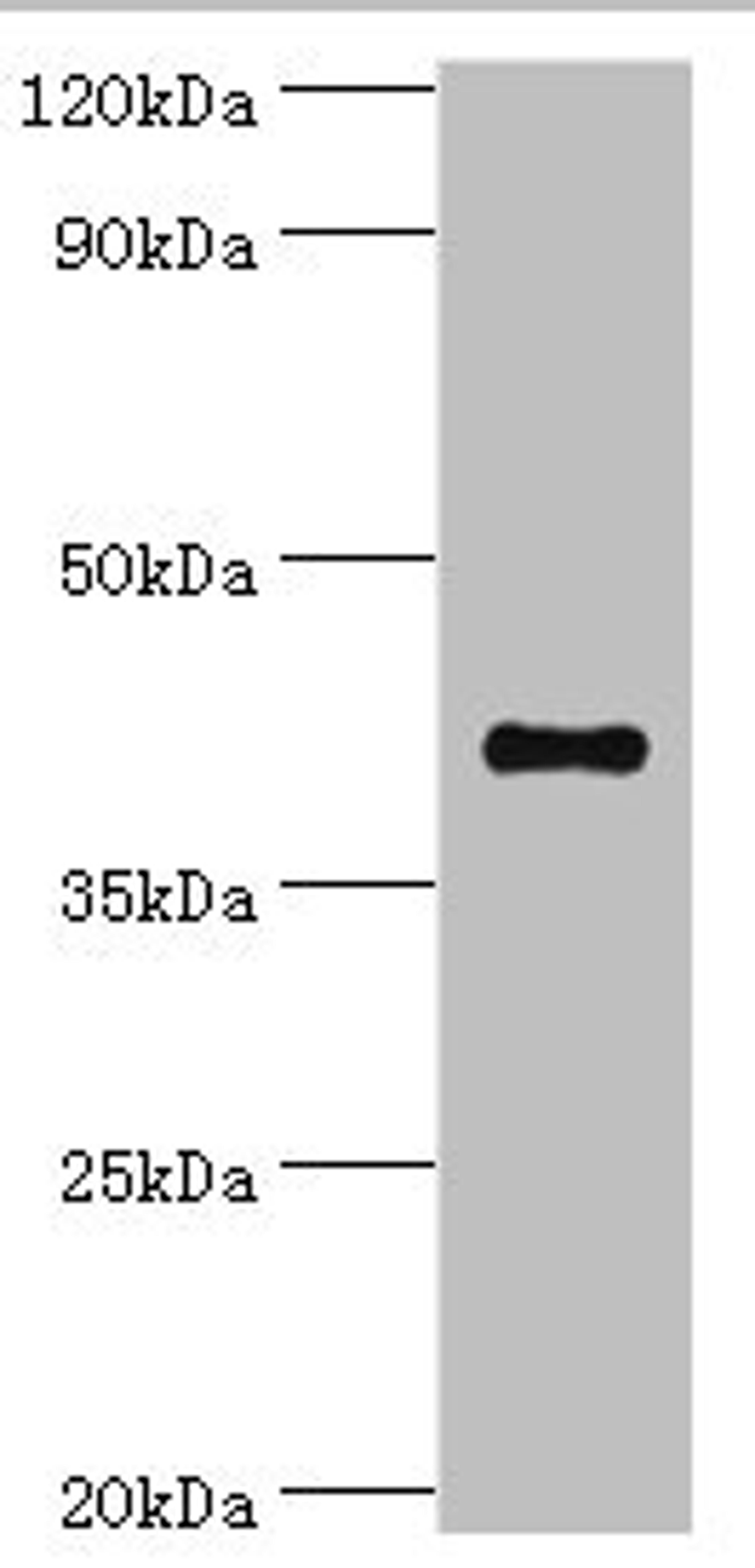 Western blot. All lanes: Sulfotransferase family cytosolic 2B member 1 antibody at 4ug/ml + MCF-7 whole cell lysate. Secondary. Goat polyclonal to rabbit IgG at 1/10000 dilution. Predicted band size: 42, 40 kDa. Observed band size: 42 kDa.