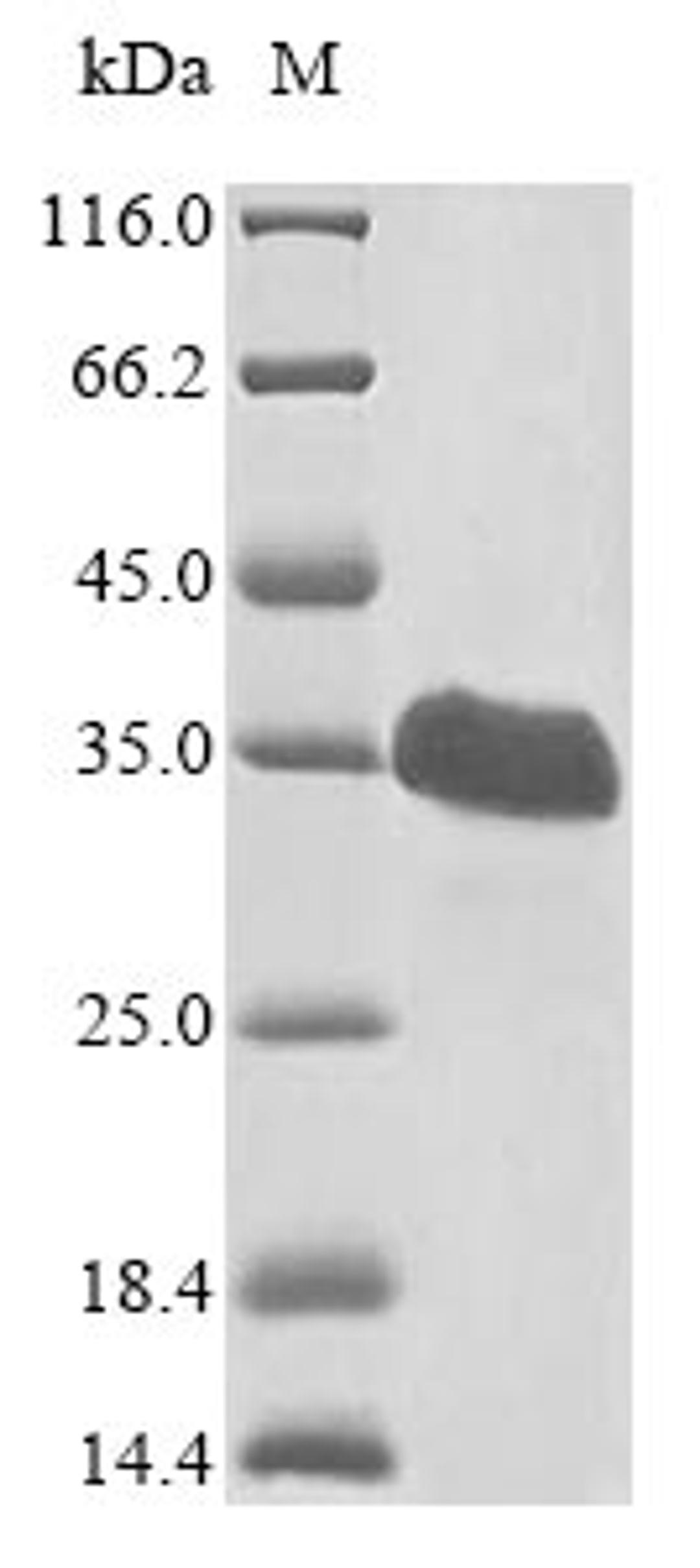 (Tris-Glycine gel) Discontinuous SDS-PAGE (reduced) with 5% enrichment gel and 15% separation gel.