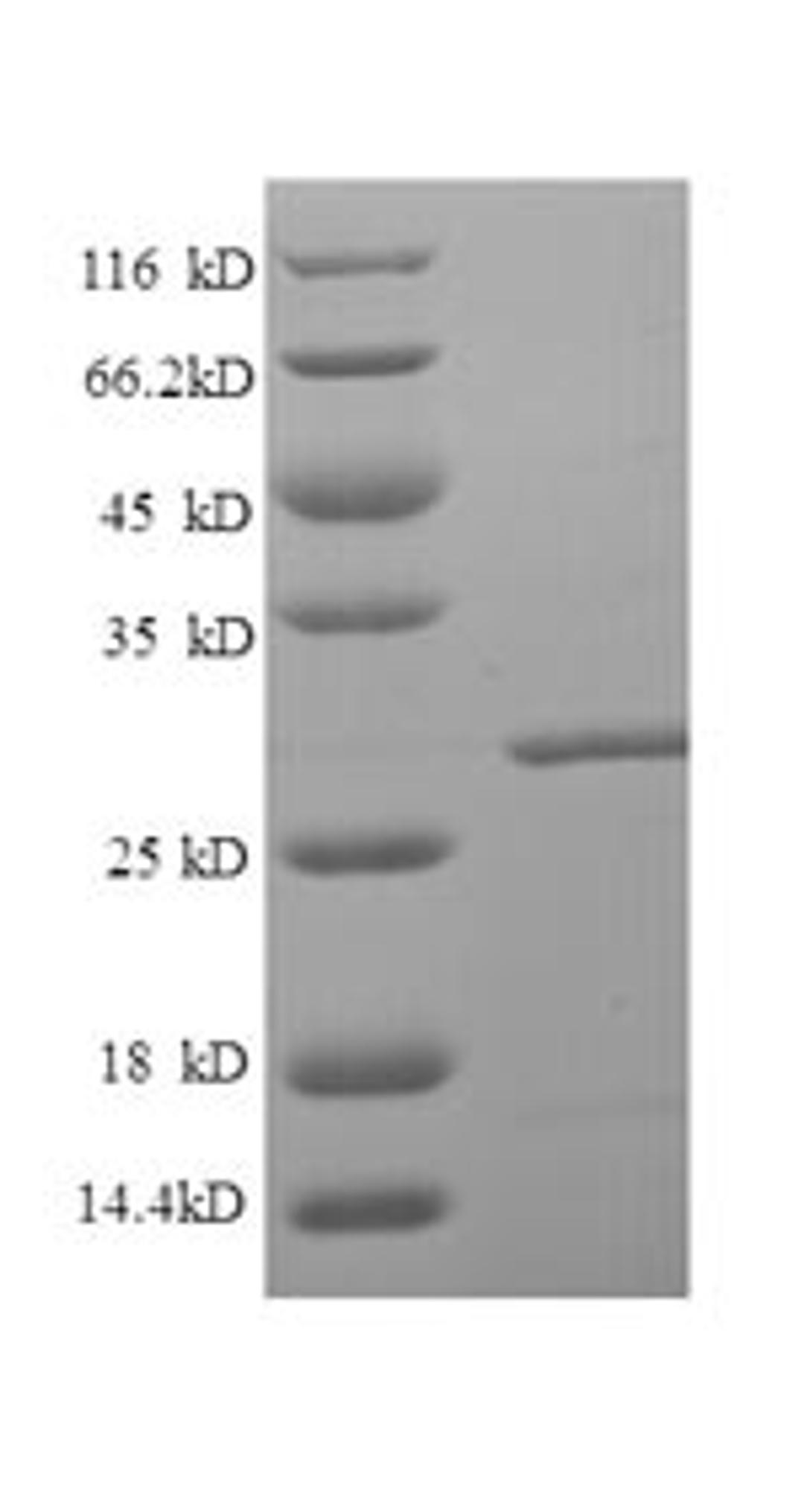 (Tris-Glycine gel) Discontinuous SDS-PAGE (reduced) with 5% enrichment gel and 15% separation gel.