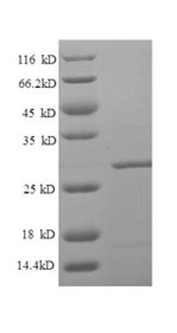 (Tris-Glycine gel) Discontinuous SDS-PAGE (reduced) with 5% enrichment gel and 15% separation gel.