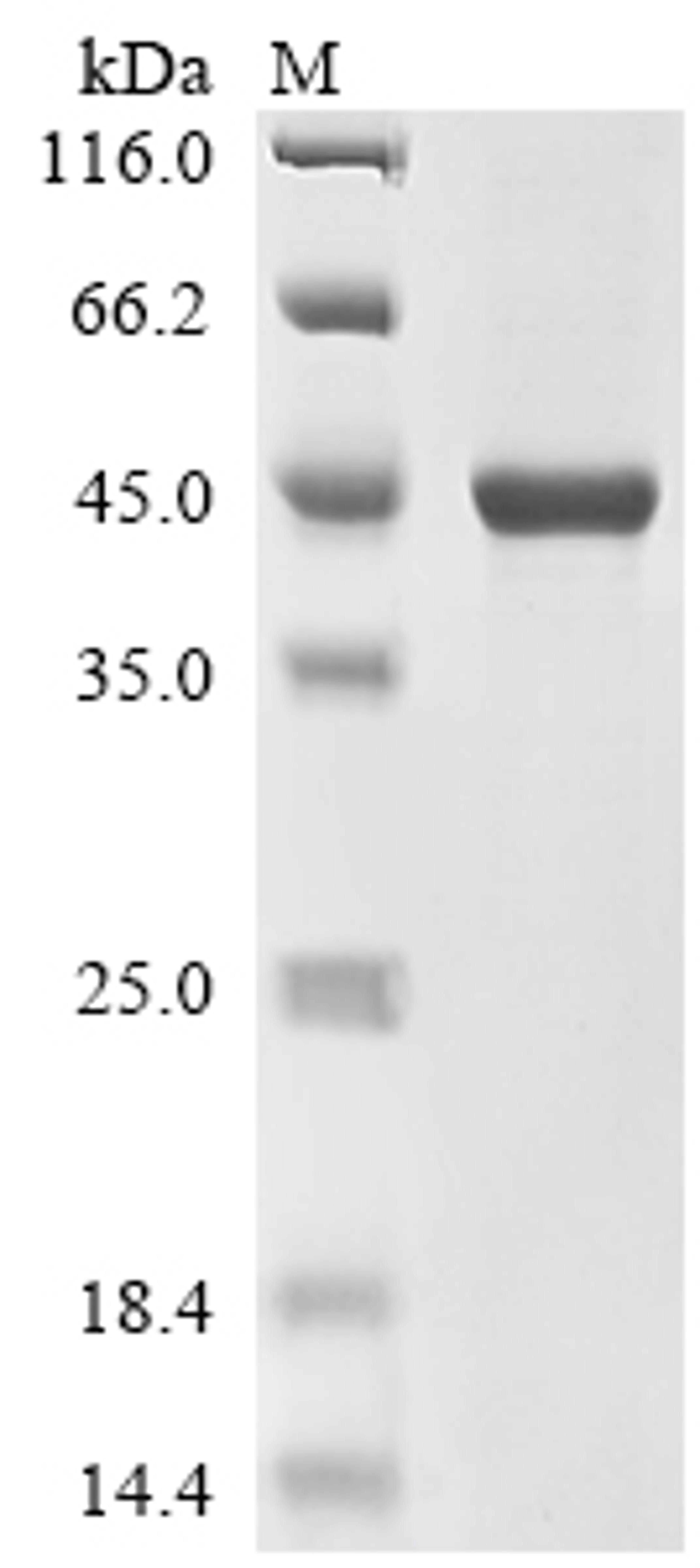 (Tris-Glycine gel) Discontinuous SDS-PAGE (reduced) with 5% enrichment gel and 15% separation gel.