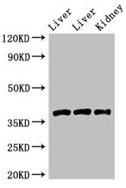 Western Blot. Positive WB detected in: Rat liver tissue, Mouse liver tissue, Mouse kidney tissue. All lanes: GNB4 antibody at 2ug/ml. Secondary. Goat polyclonal to rabbit IgG at 1/50000 dilution. Predicted band size: 38 kDa. Observed band size: 38 kDa. 