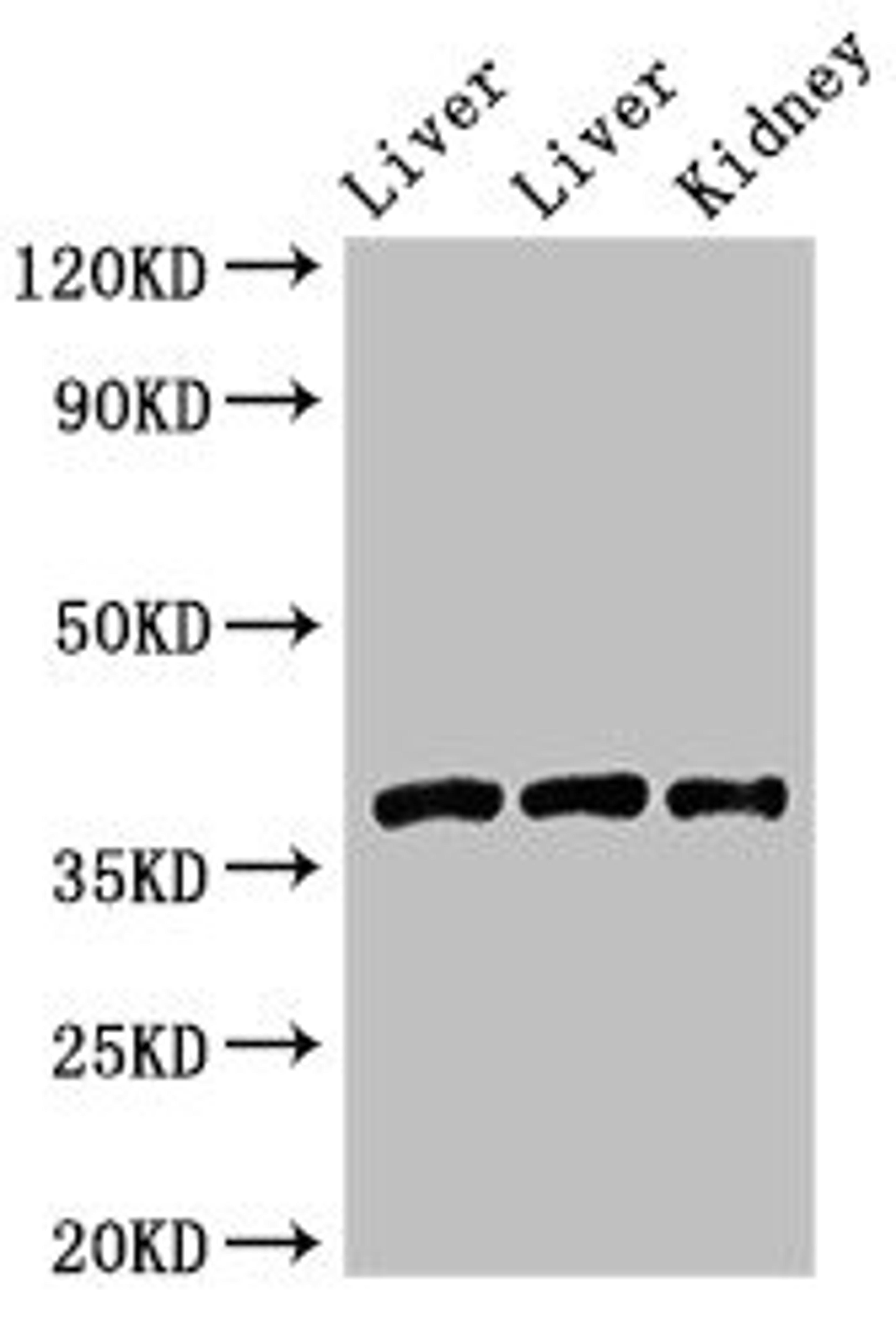 Western Blot. Positive WB detected in: Rat liver tissue, Mouse liver tissue, Mouse kidney tissue. All lanes: GNB4 antibody at 2ug/ml. Secondary. Goat polyclonal to rabbit IgG at 1/50000 dilution. Predicted band size: 38 kDa. Observed band size: 38 kDa. 
