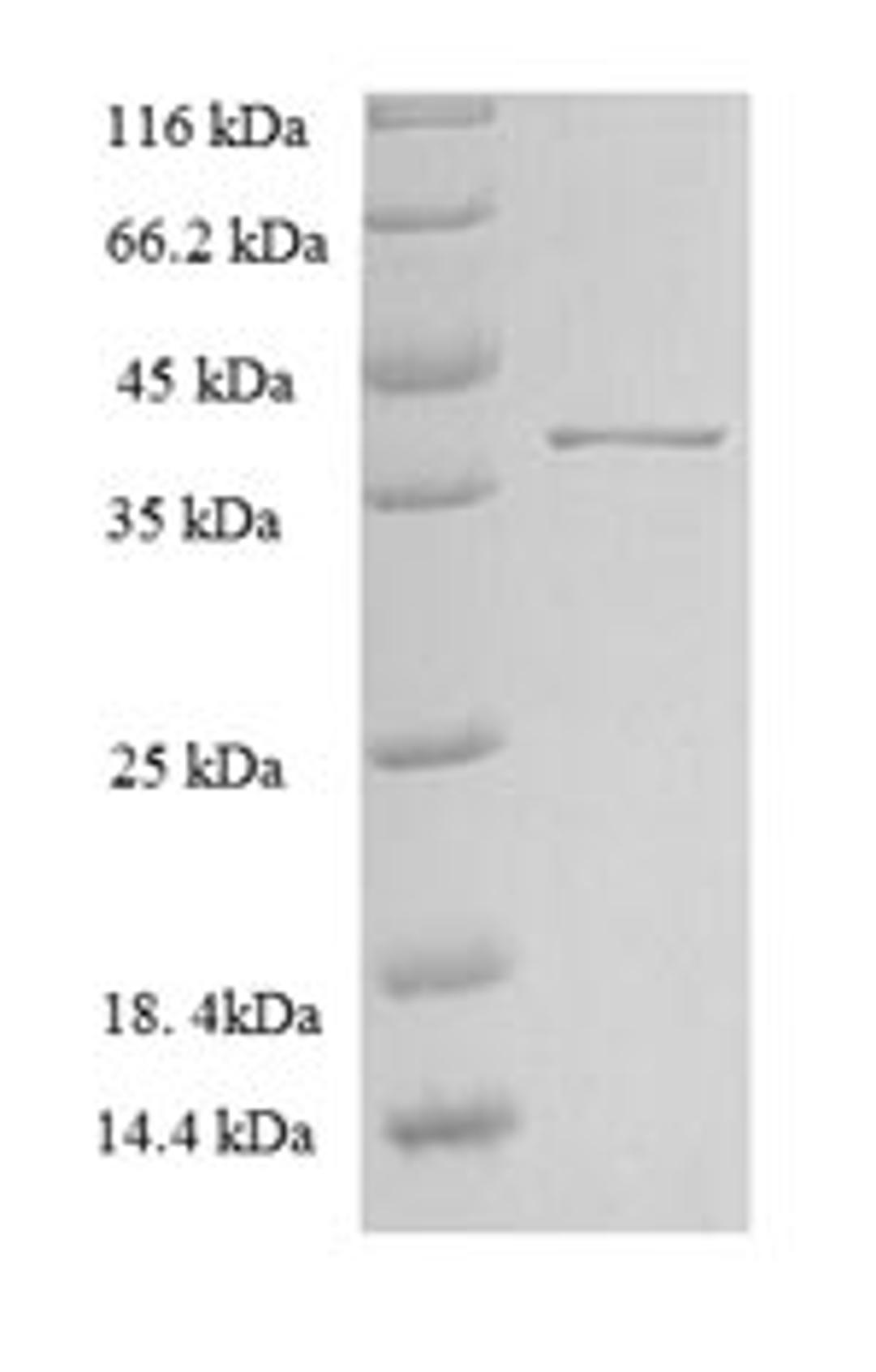 (Tris-Glycine gel) Discontinuous SDS-PAGE (reduced) with 5% enrichment gel and 15% separation gel.