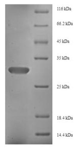 (Tris-Glycine gel) Discontinuous SDS-PAGE (reduced) with 5% enrichment gel and 15% separation gel.