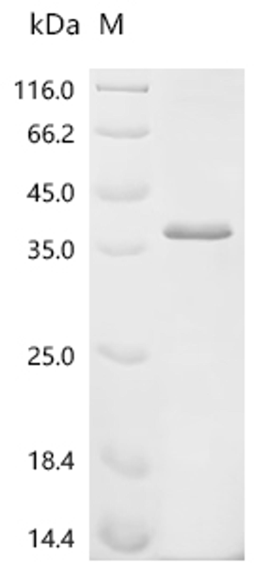 (Tris-Glycine gel) Discontinuous SDS-PAGE (reduced) with 5% enrichment gel and 15% separation gel.
