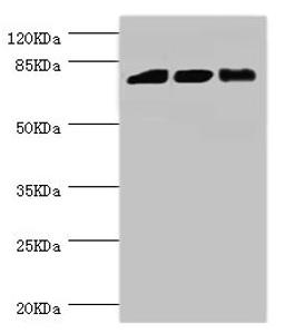 Western blot. All lanes: DGKA antibody at 6.48µg/ml. Lane 1: Hela whole cell lysate. Lane 2: Jurkat whole cell lysate. Lane 3: 293T whole cell lysate. Secondary. Goat polyclonal to rabbit IgG at 1/10000 dilution. Predicted band size: 83, 14, 29 kDa. Observed band size: 83 kDa