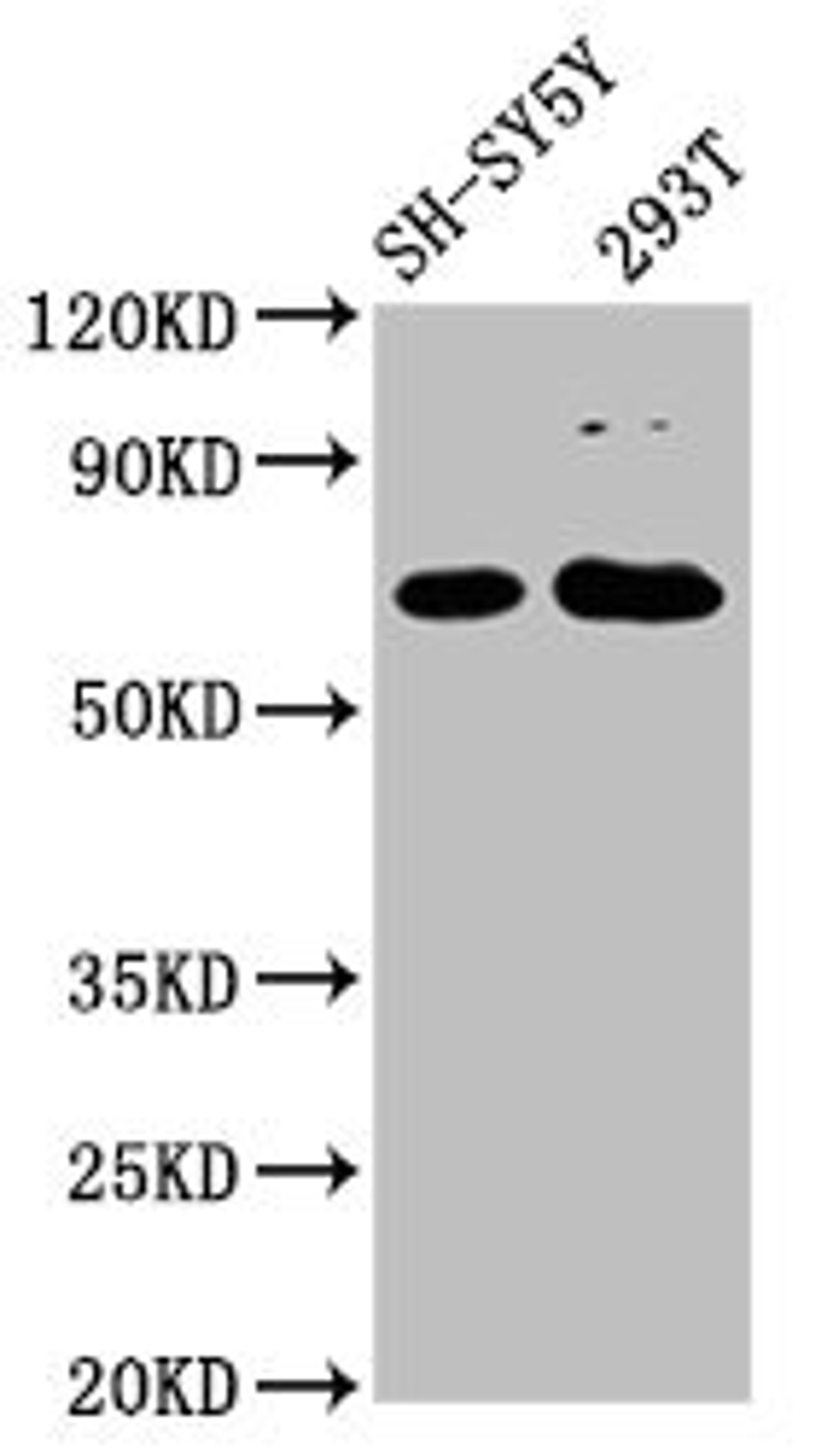 Western Blot. Positive WB detected in: SH-SY5Y whole cell lysate, 293T whole cell lysate. All lanes: GALNT9 antibody at 2.4µg/ml. Secondary. Goat polyclonal to rabbit IgG at 1/50000 dilution. Predicted band size: 69, 28 kDa. Observed band size: 69 kDa. 