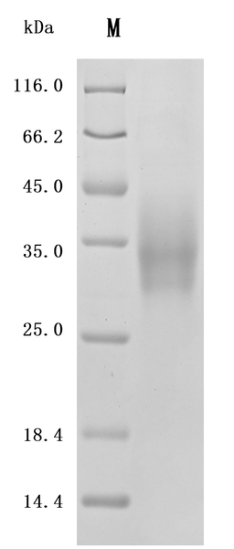 (Tris-Glycine gel) Discontinuous SDS-PAGE (reduced) with 5% enrichment gel and 15% separation gel.
