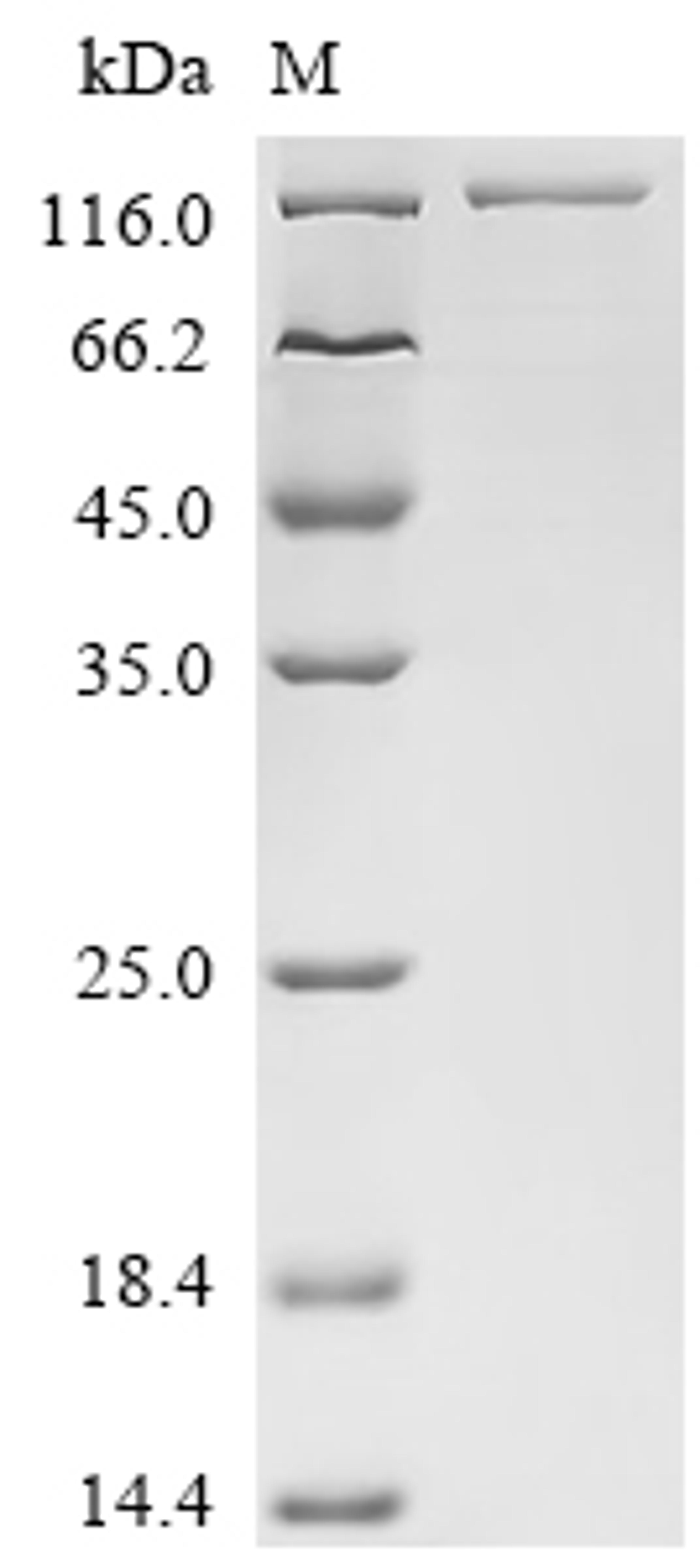 (Tris-Glycine gel) Discontinuous SDS-PAGE (reduced) with 5% enrichment gel and 15% separation gel.