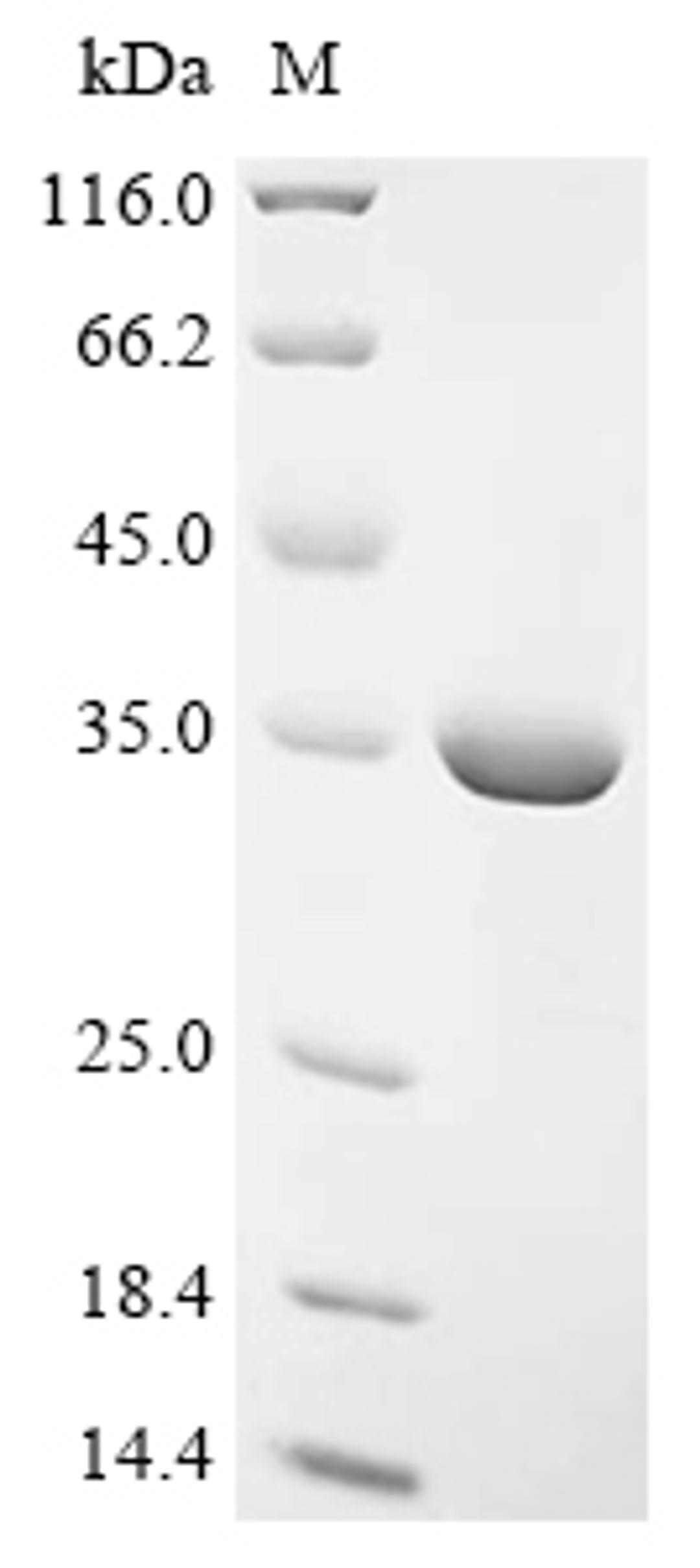 (Tris-Glycine gel) Discontinuous SDS-PAGE (reduced) with 5% enrichment gel and 15% separation gel.