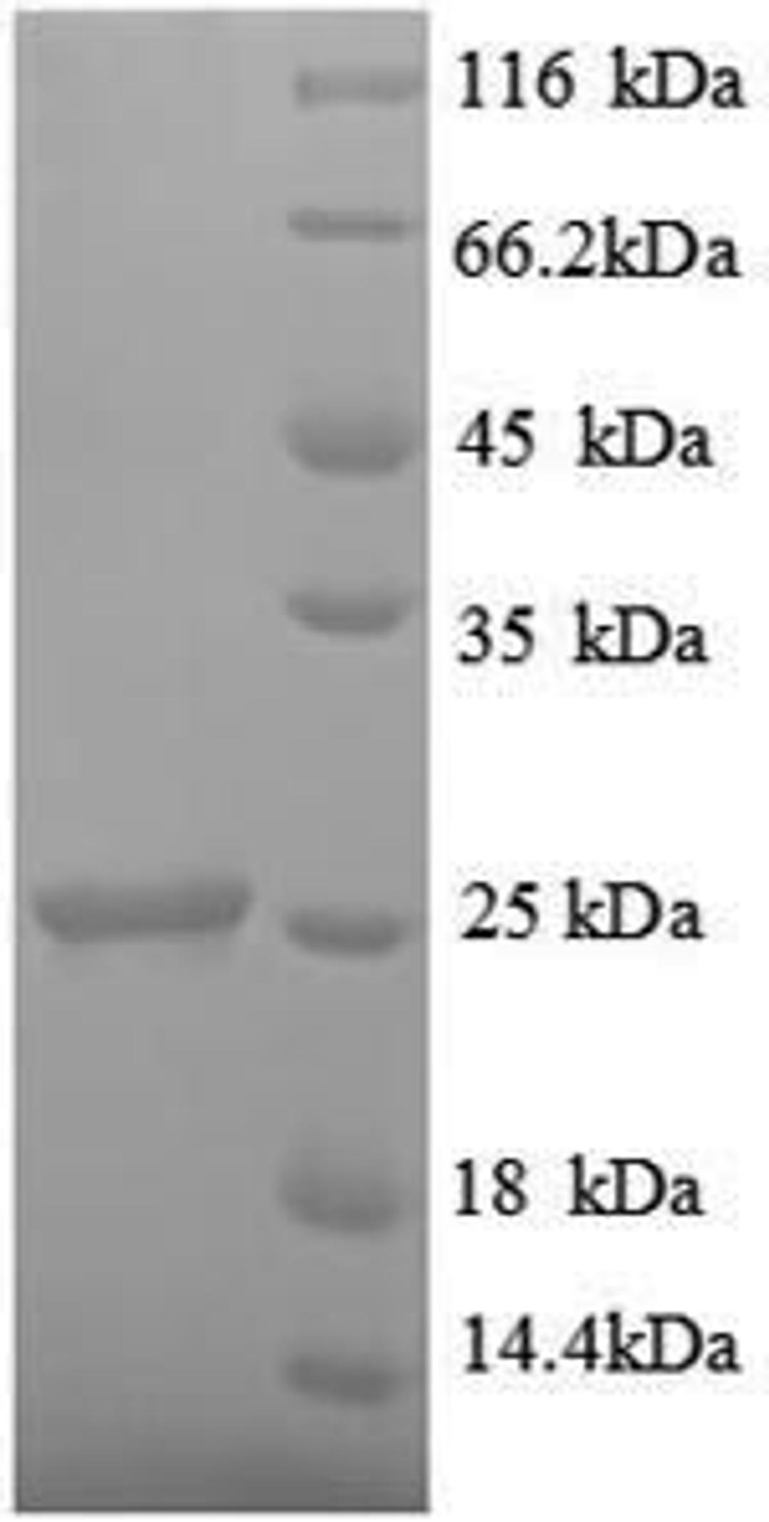 (Tris-Glycine gel) Discontinuous SDS-PAGE (reduced) with 5% enrichment gel and 15% separation gel.