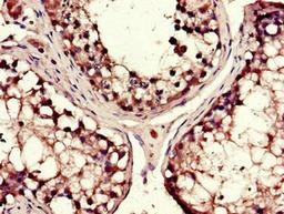 Immunohistochemistry of paraffin-embedded human testis tissue using CSB-PA613491LA01HU at dilution of 1:100