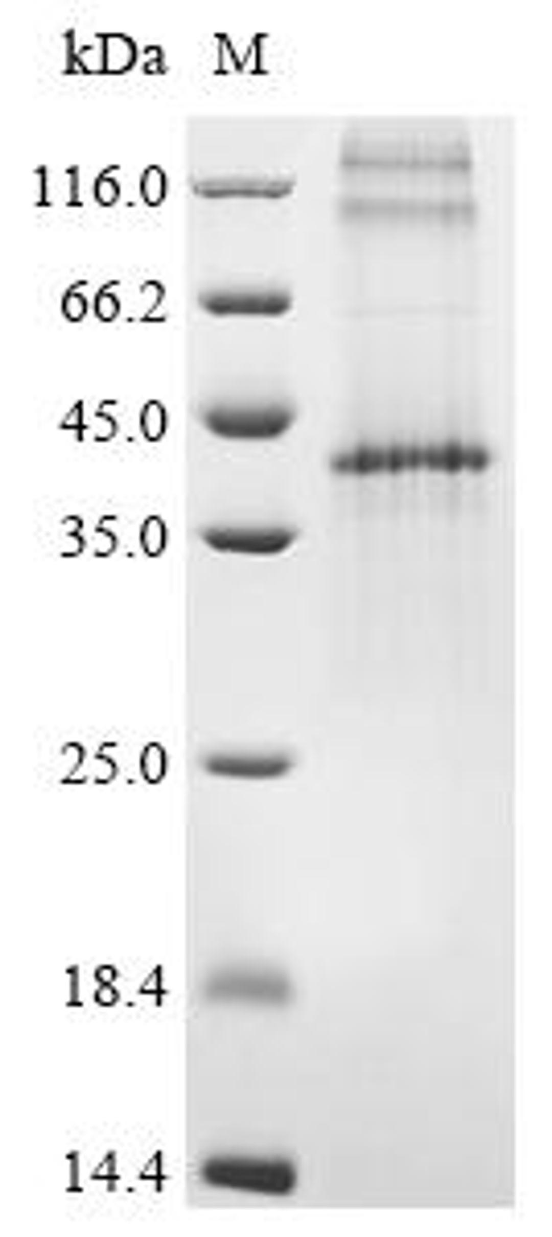 (Tris-Glycine gel) Discontinuous SDS-PAGE (reduced) with 5% enrichment gel and 15% separation gel.
