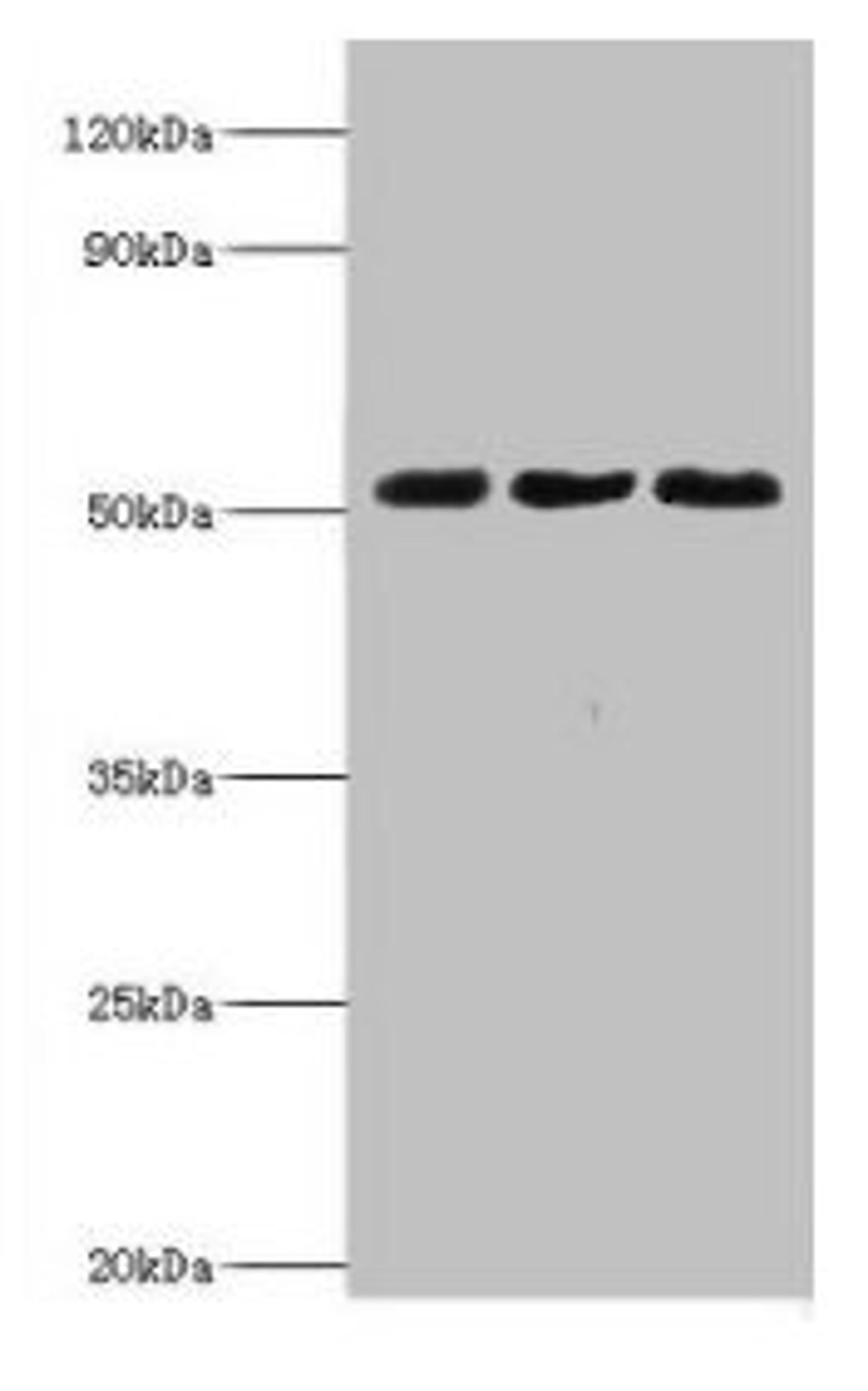 Western blot. All lanes: BAG family molecular chaperone regulator 5 antibody at 2ug/ml. Lane 1: Mouse kidney tissue. Lane 2: Mouse brain tissue. Lane 3: Hela whole cell lysate. Secondary. Goat polyclonal to rabbit IgG at 1/10000 dilution. Predicted band size: 52, 57 kDa. Observed band size: 52 kDa. 