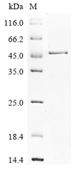 (Tris-Glycine gel) Discontinuous SDS-PAGE (reduced) with 5% enrichment gel and 15% separation gel.